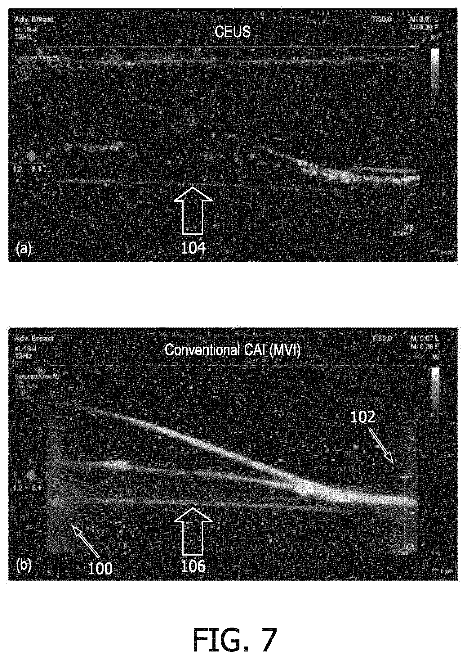 Patent US12564381 Figure 7 – Systems and methods for contrast enhanced imaging