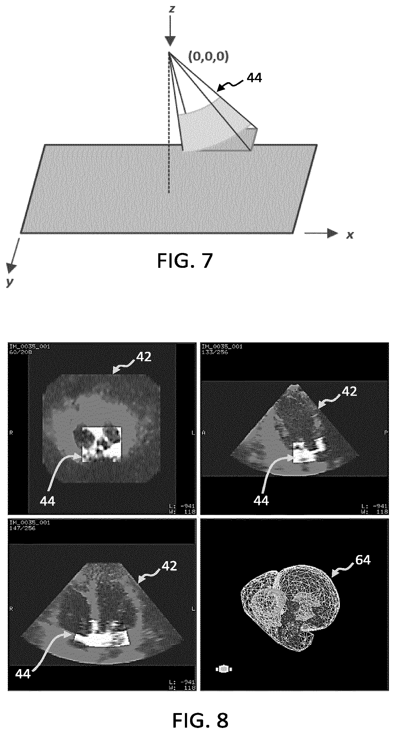 Patent US12564382 Figure 4 – 3D ultrasound imaging with FOV adaptation
