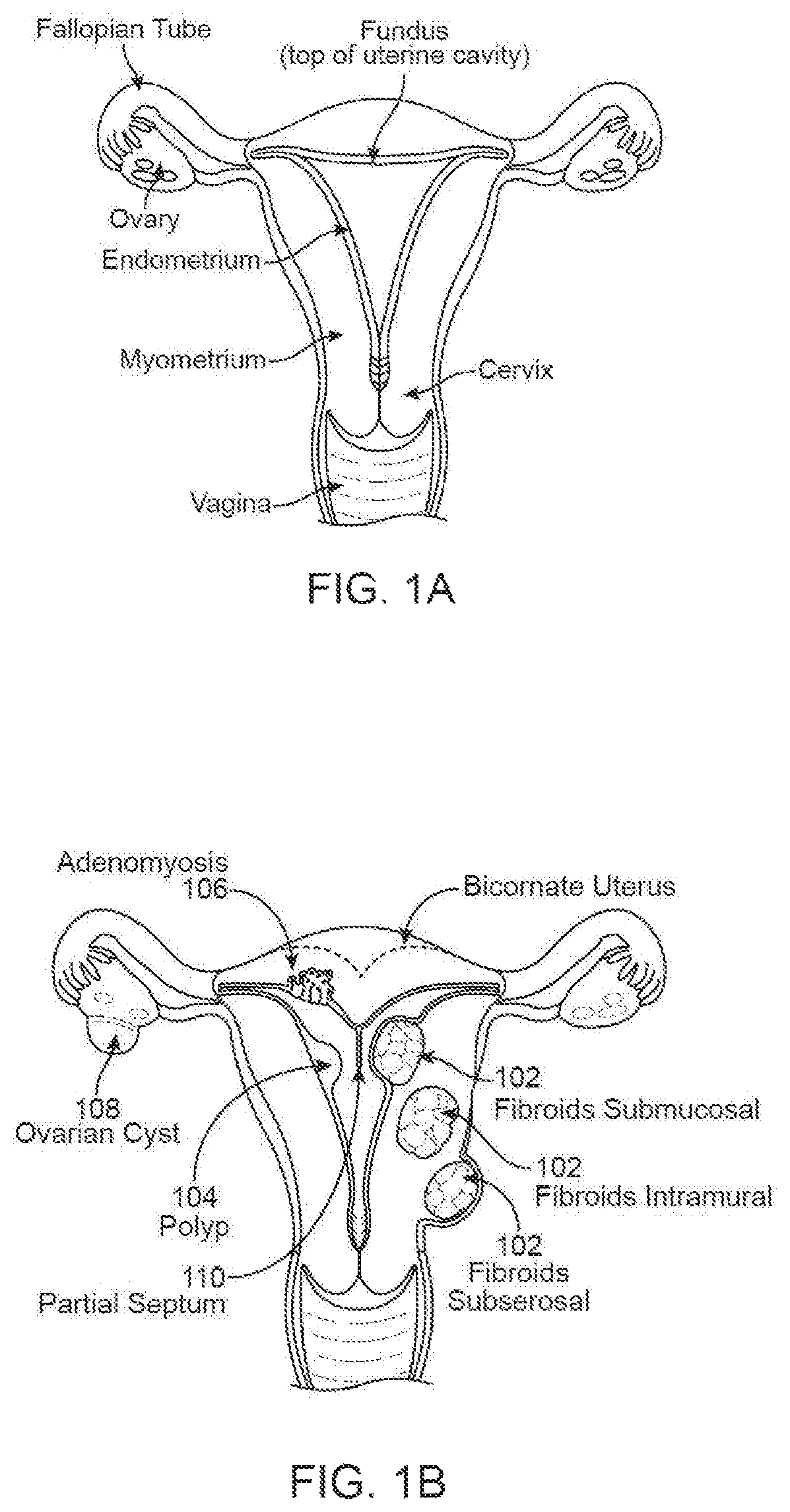 Patent US12564383 Figure 1 – Enhanced ultrasound imaging apparatus and associated methods of work flow