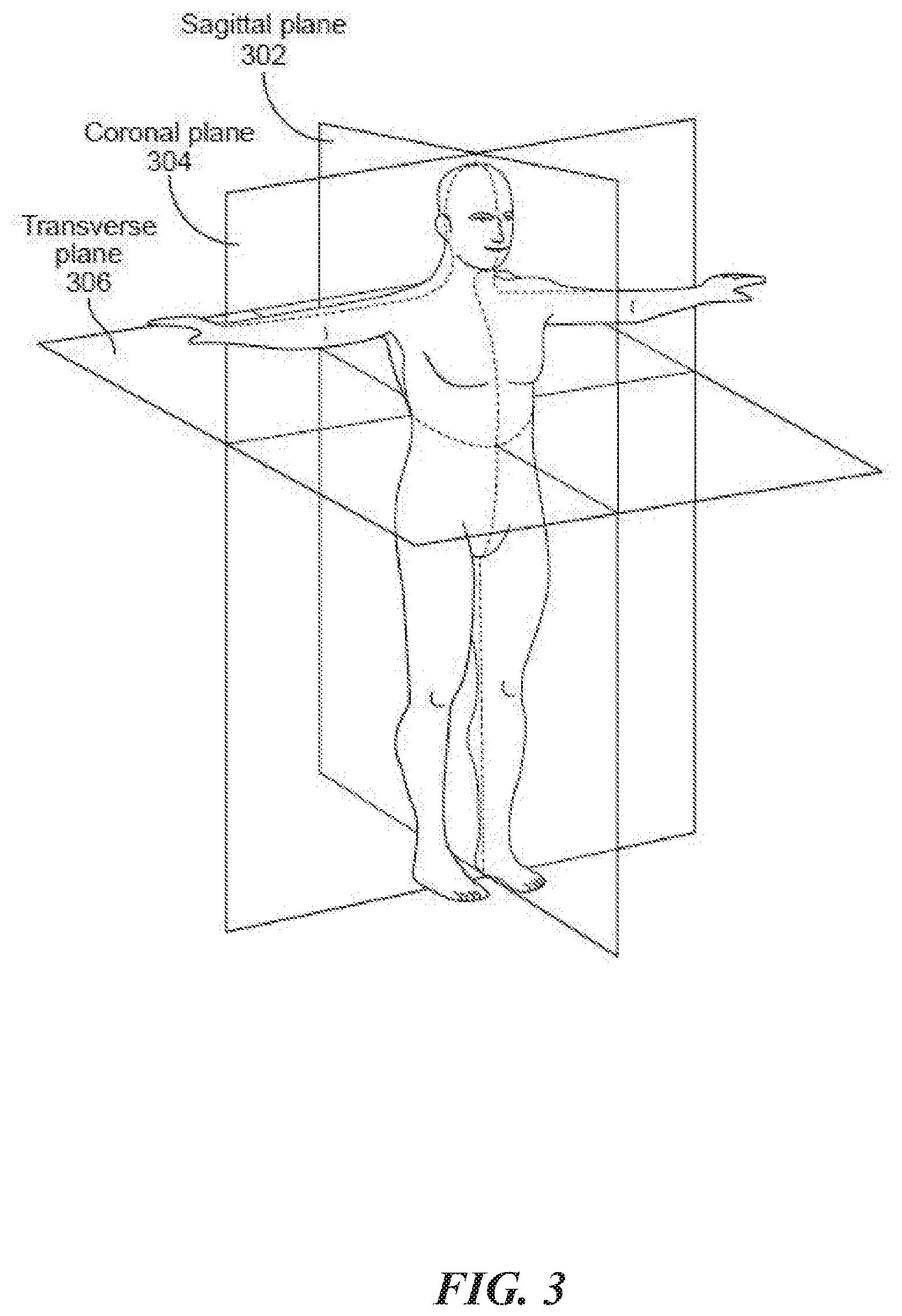 Patent US12564383 Figure 3 – Enhanced ultrasound imaging apparatus and associated methods of work flow