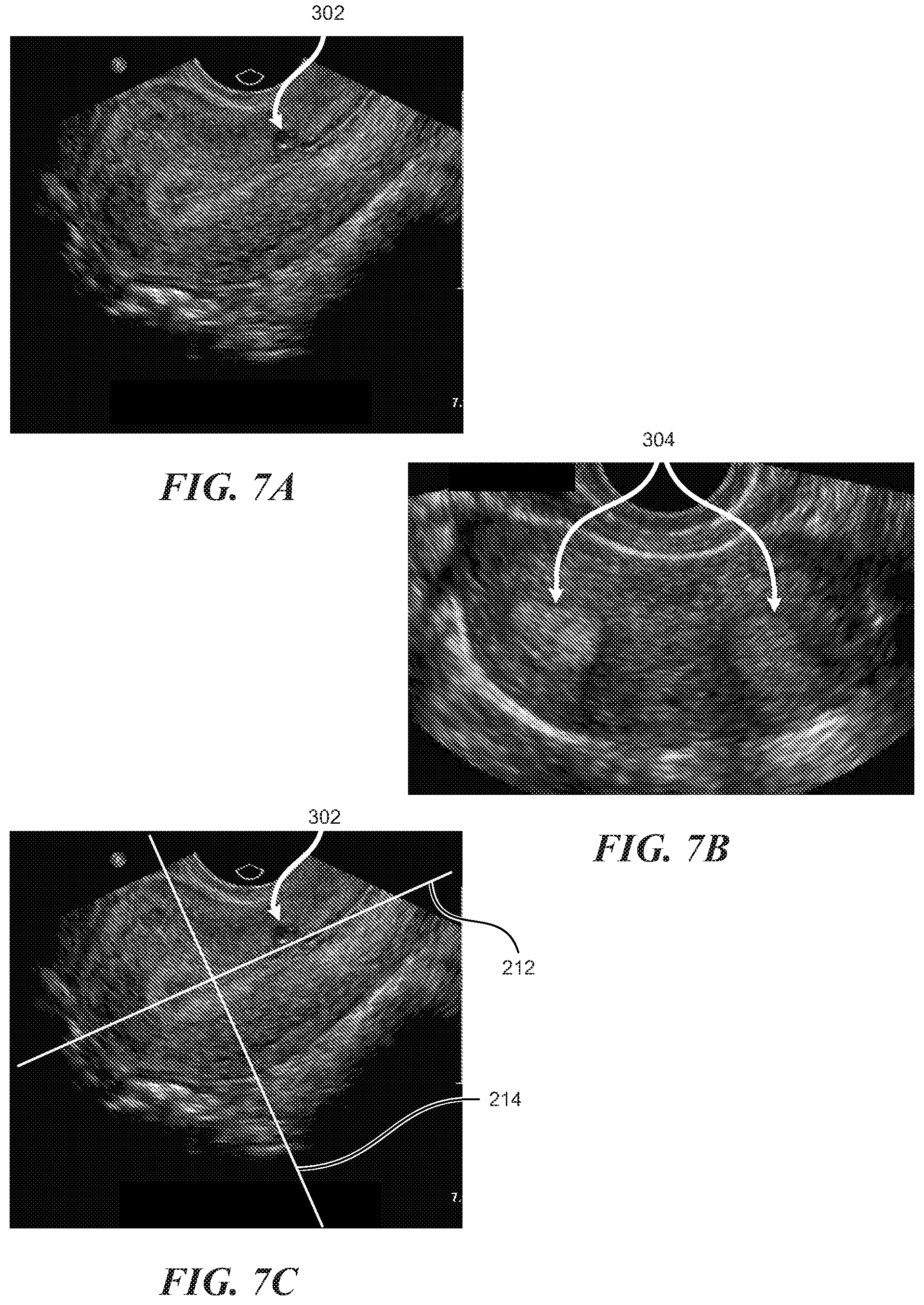Patent US12564383 Figure 7 – Enhanced ultrasound imaging apparatus and associated methods of work flow