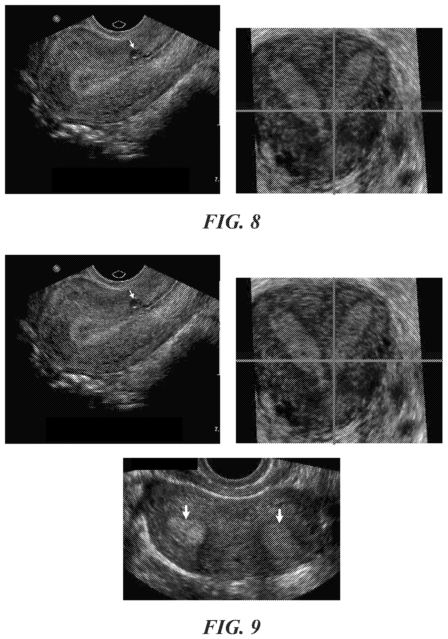 Patent US12564383 Figure 8 – Enhanced ultrasound imaging apparatus and associated methods of work flow
