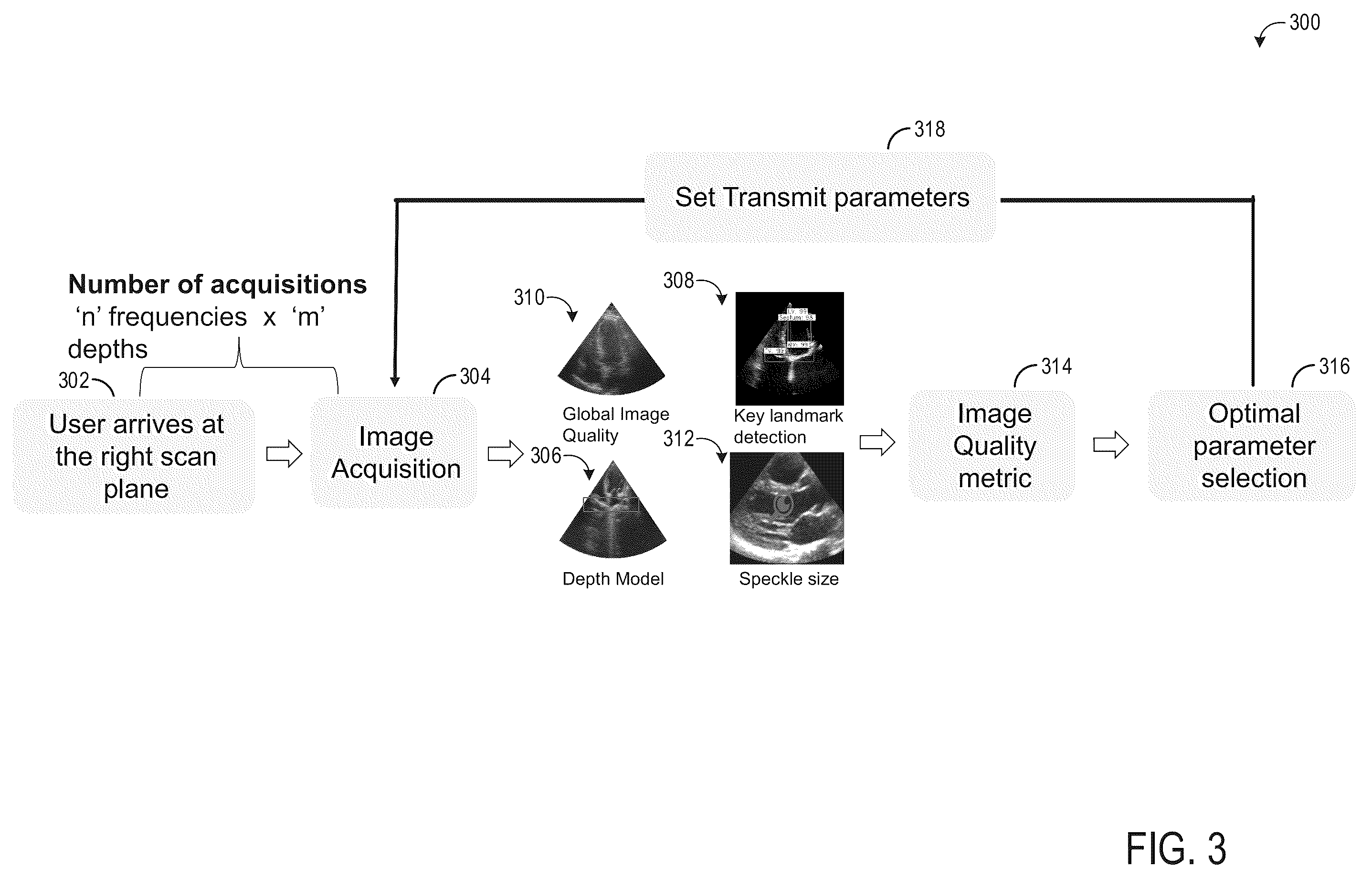 Patent US12564384 Figure 3 – System and methods for joint scan parameter selection