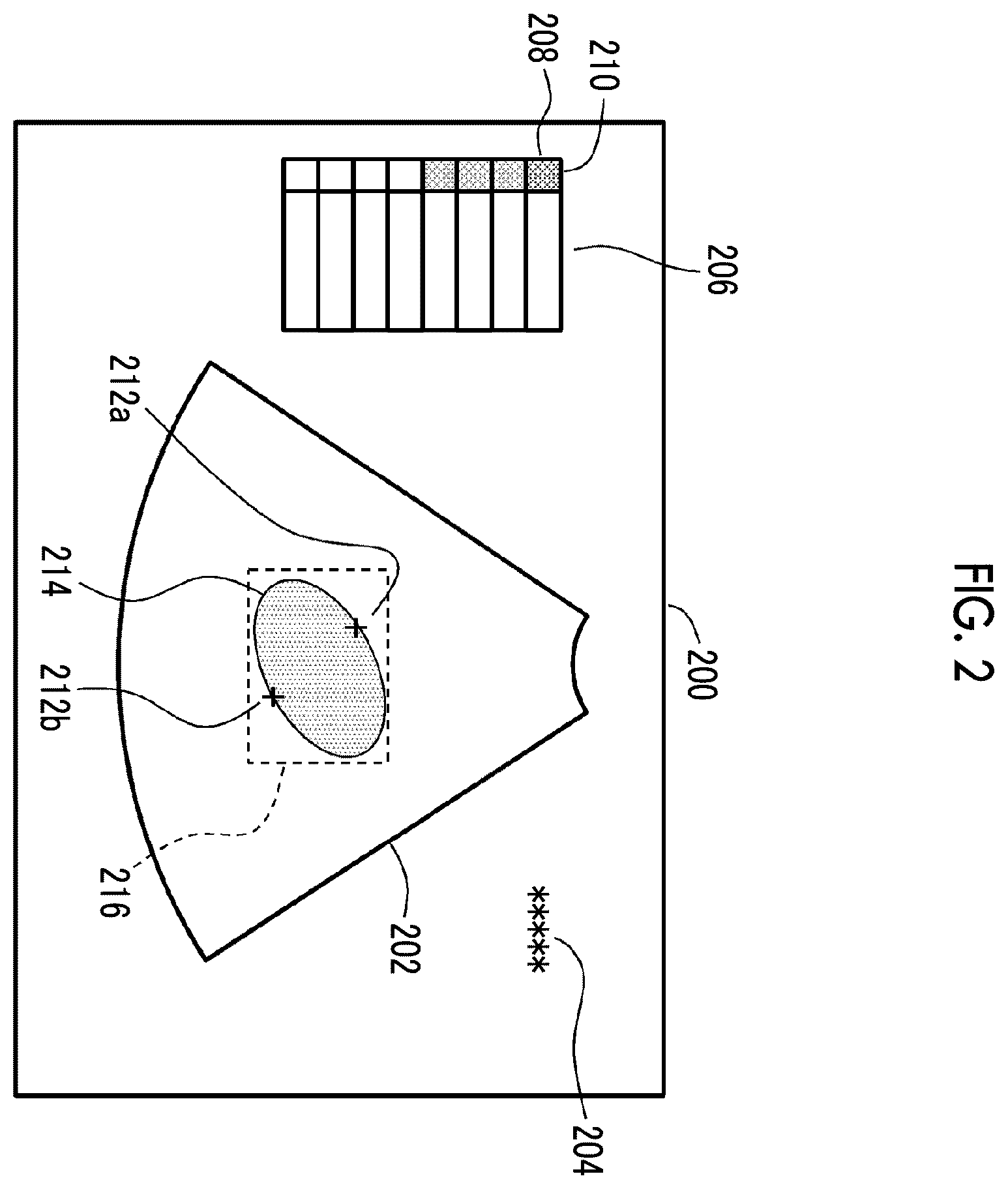 Patent US12564387 Figure 2 – Ultrasound diagnostic apparatus and ultrasound diagnostic system