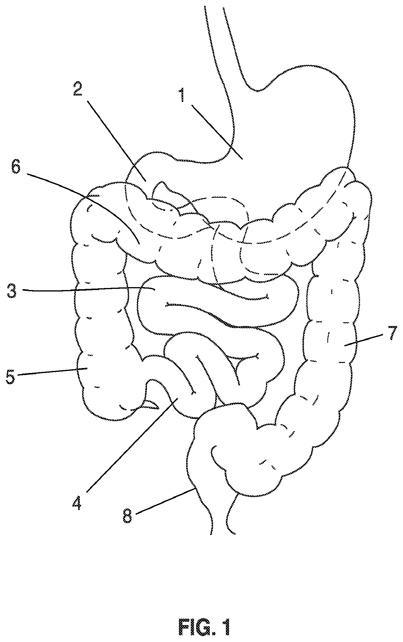 Patent US12564389 — Devices and methods for sampling gastrointestinal fluids and assessing gastrointestinal function — Figure 1