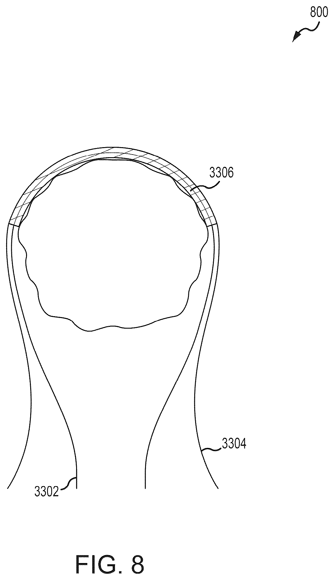 Patent US12564392 Figure 8 – Containment bag