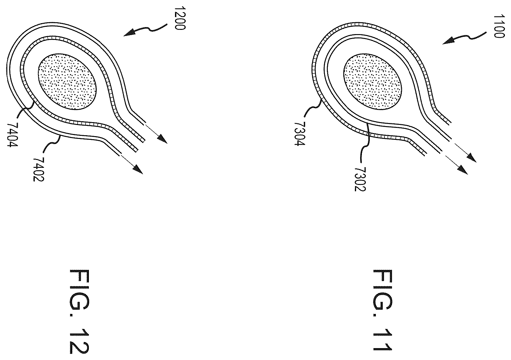 Patent US12564392 Figure 11 – Containment bag