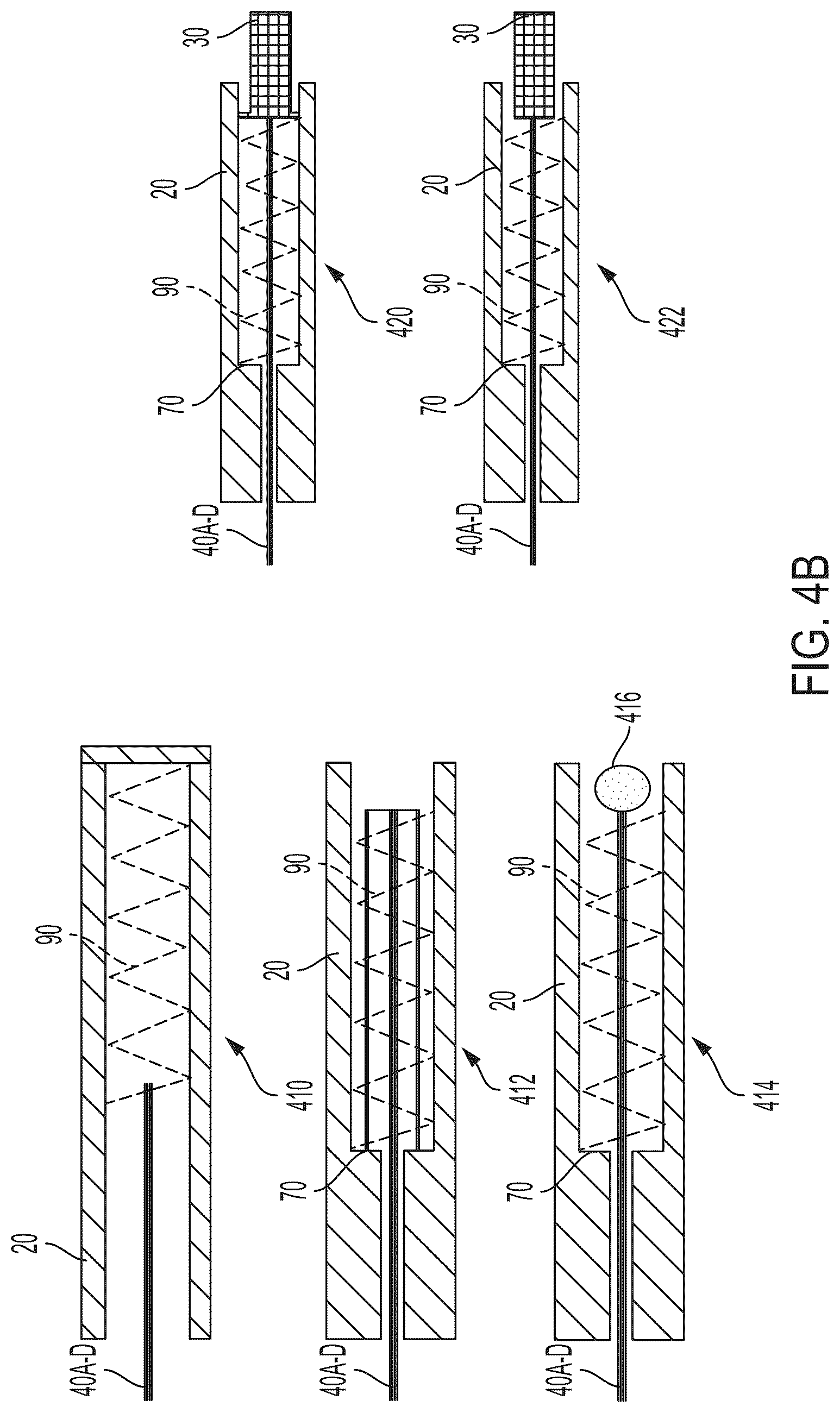 Patent US12564393 Figure 5 – Access site management system for percutaneous vascular access