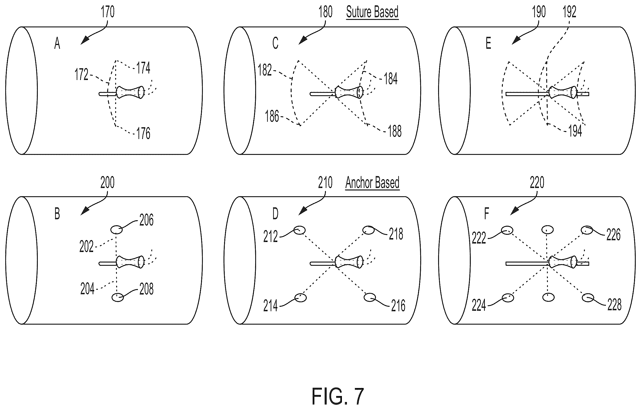 Patent US12564393 Figure 10 – Access site management system for percutaneous vascular access