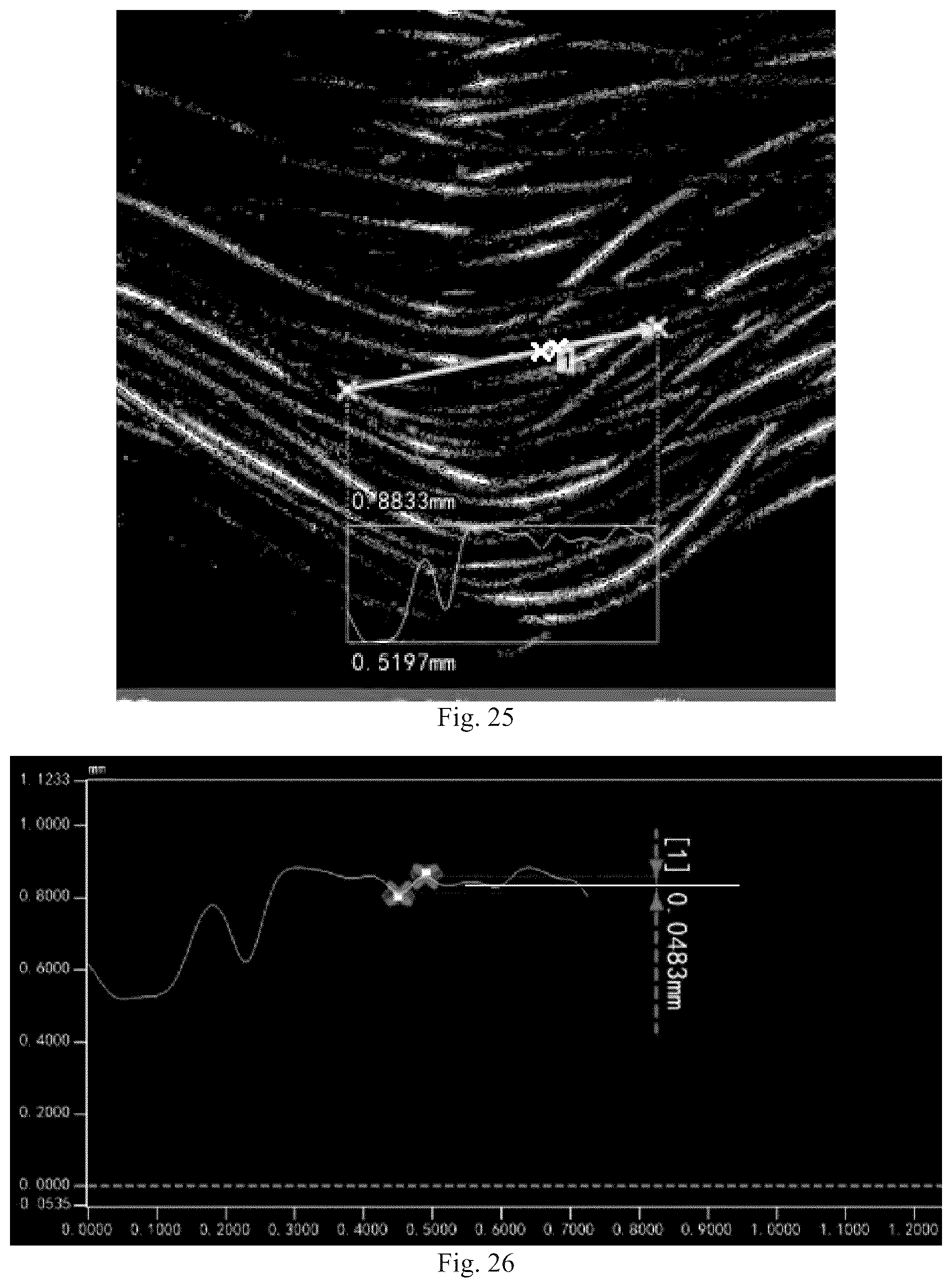 Patent US12564394 Figure 12 – Occluder and occluding system