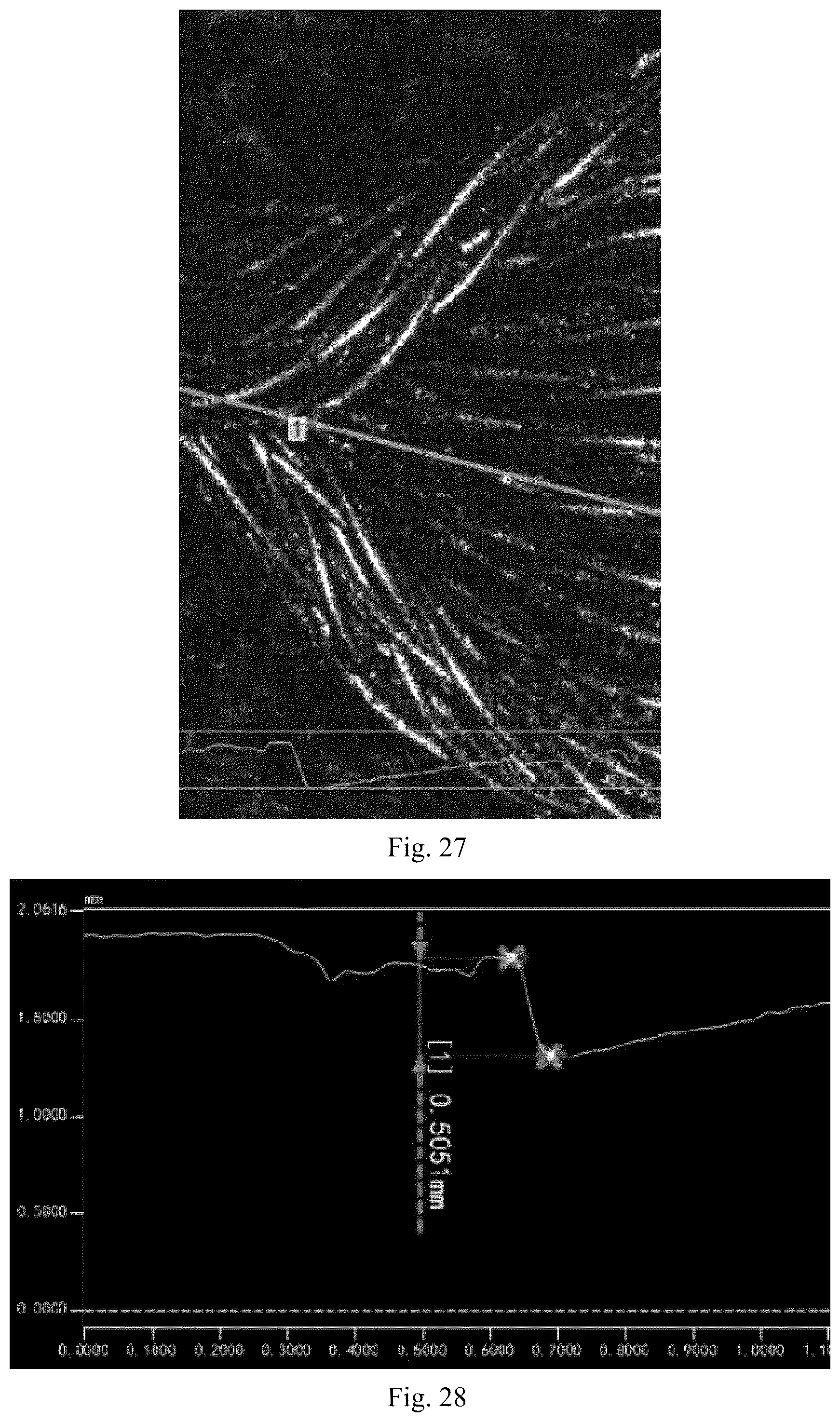 Patent US12564394 Figure 13 – Occluder and occluding system