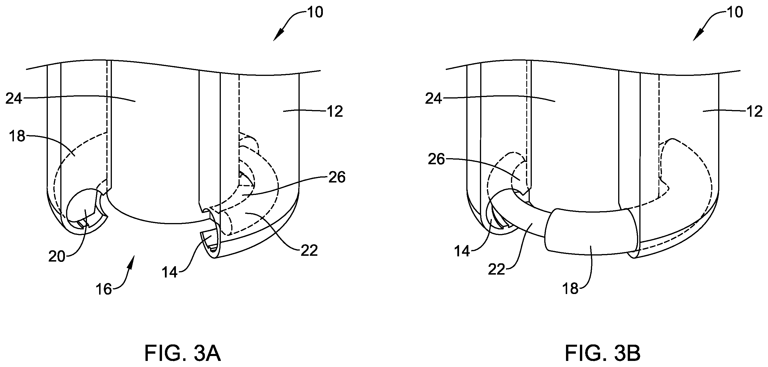 Patent US12564396 Figure 3 – Suture based closure device