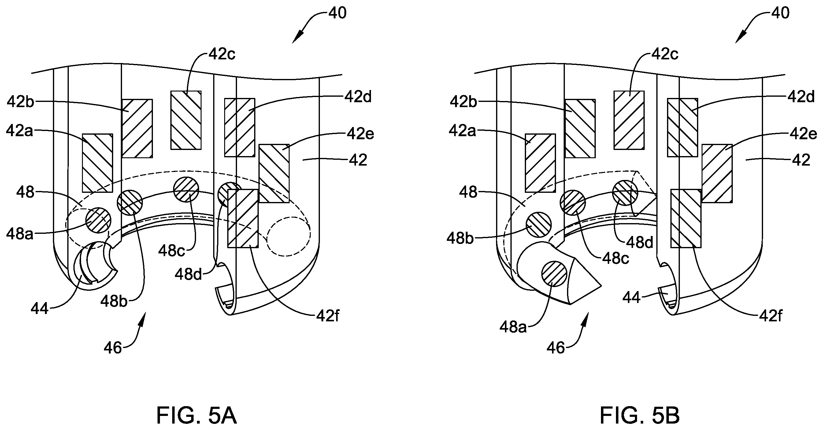 Patent US12564396 Figure 5 – Suture based closure device
