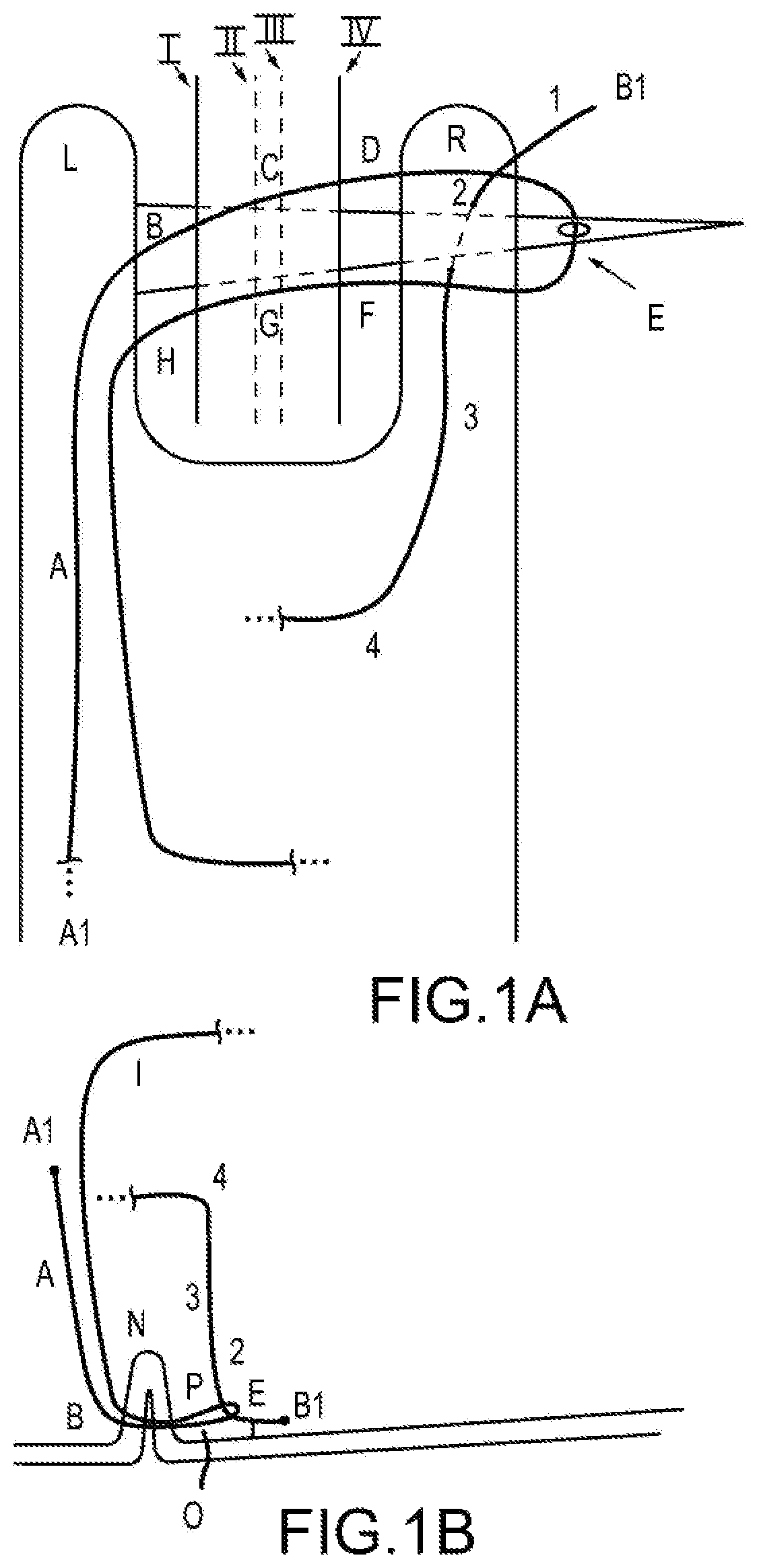 Patent US12564397 Figure 1 – Surgical device for complex suturing fibrous tissues