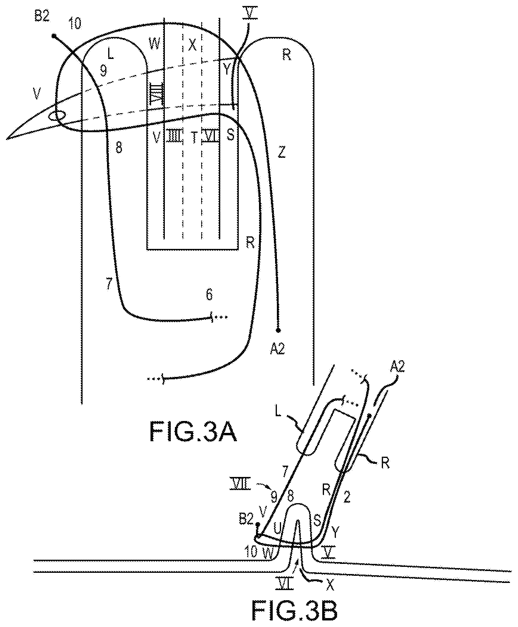 Patent US12564397 Figure 3 – Surgical device for complex suturing fibrous tissues