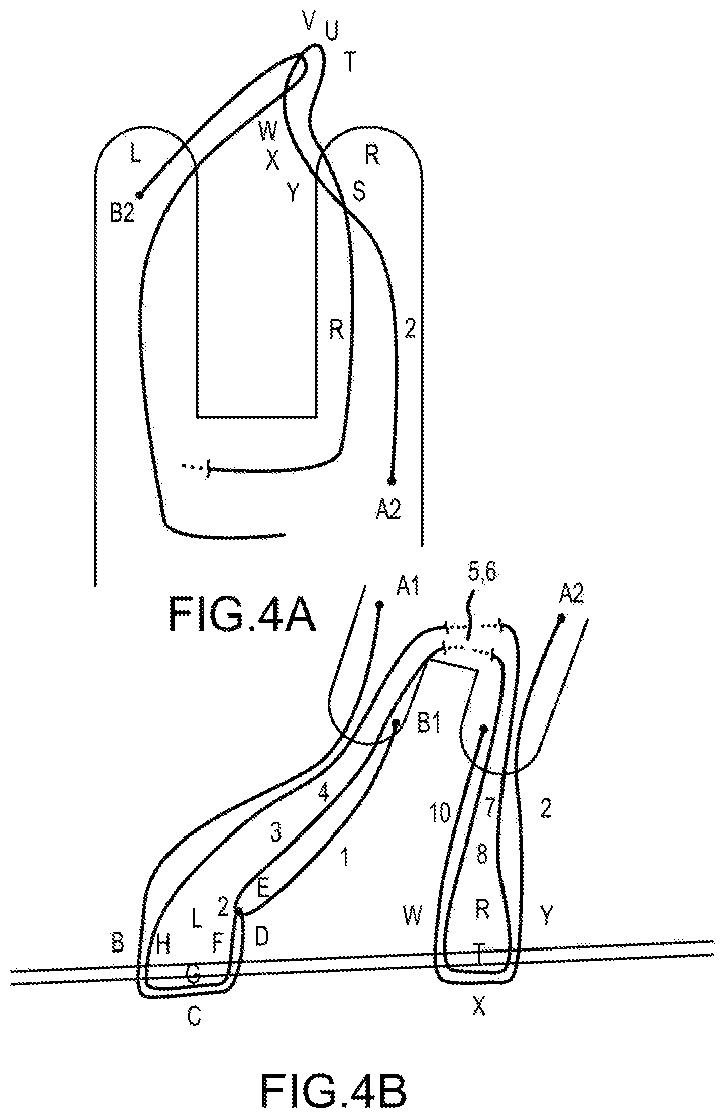 Patent US12564397 Figure 4 – Surgical device for complex suturing fibrous tissues
