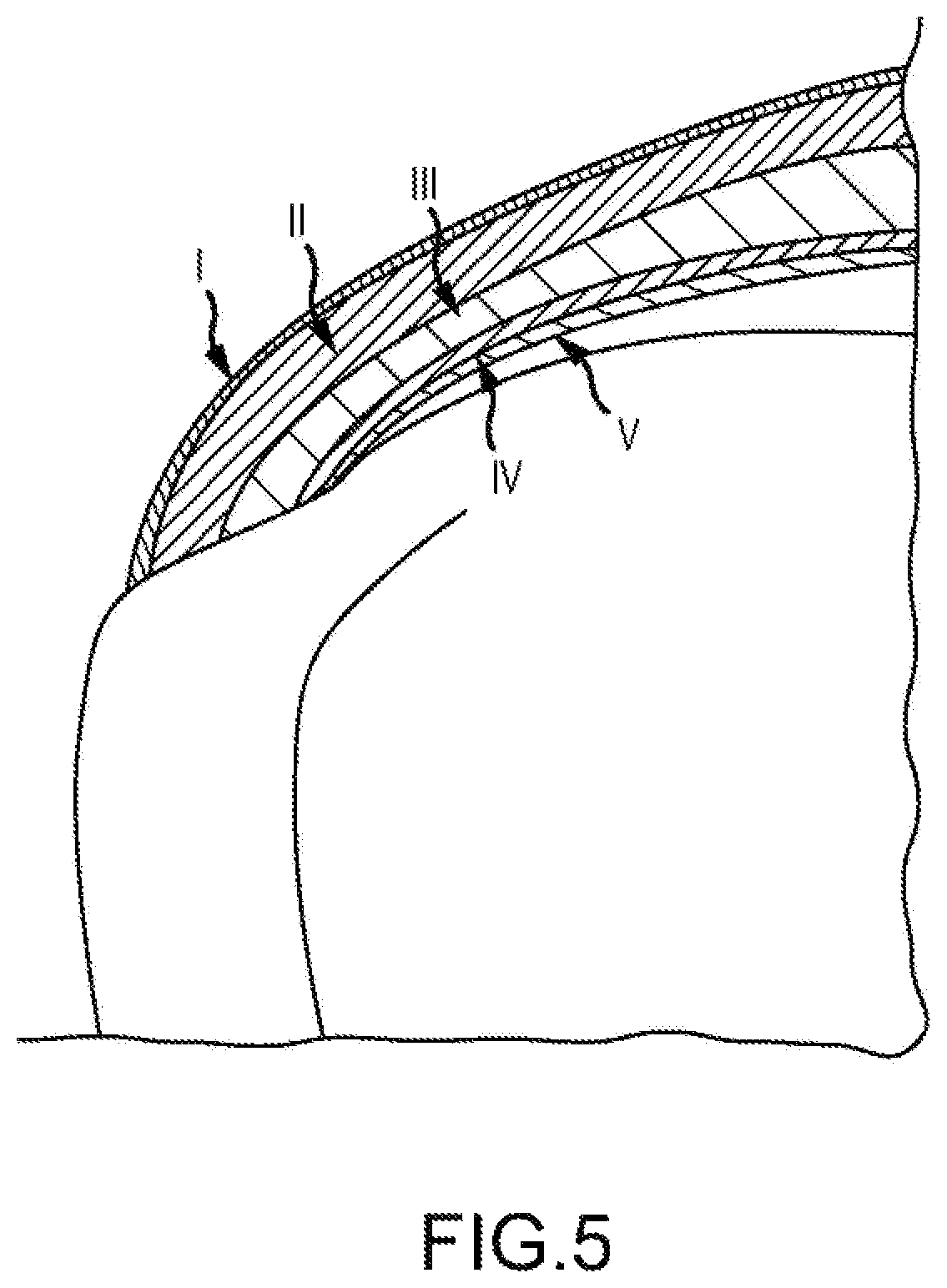 Patent US12564397 Figure 5 – Surgical device for complex suturing fibrous tissues