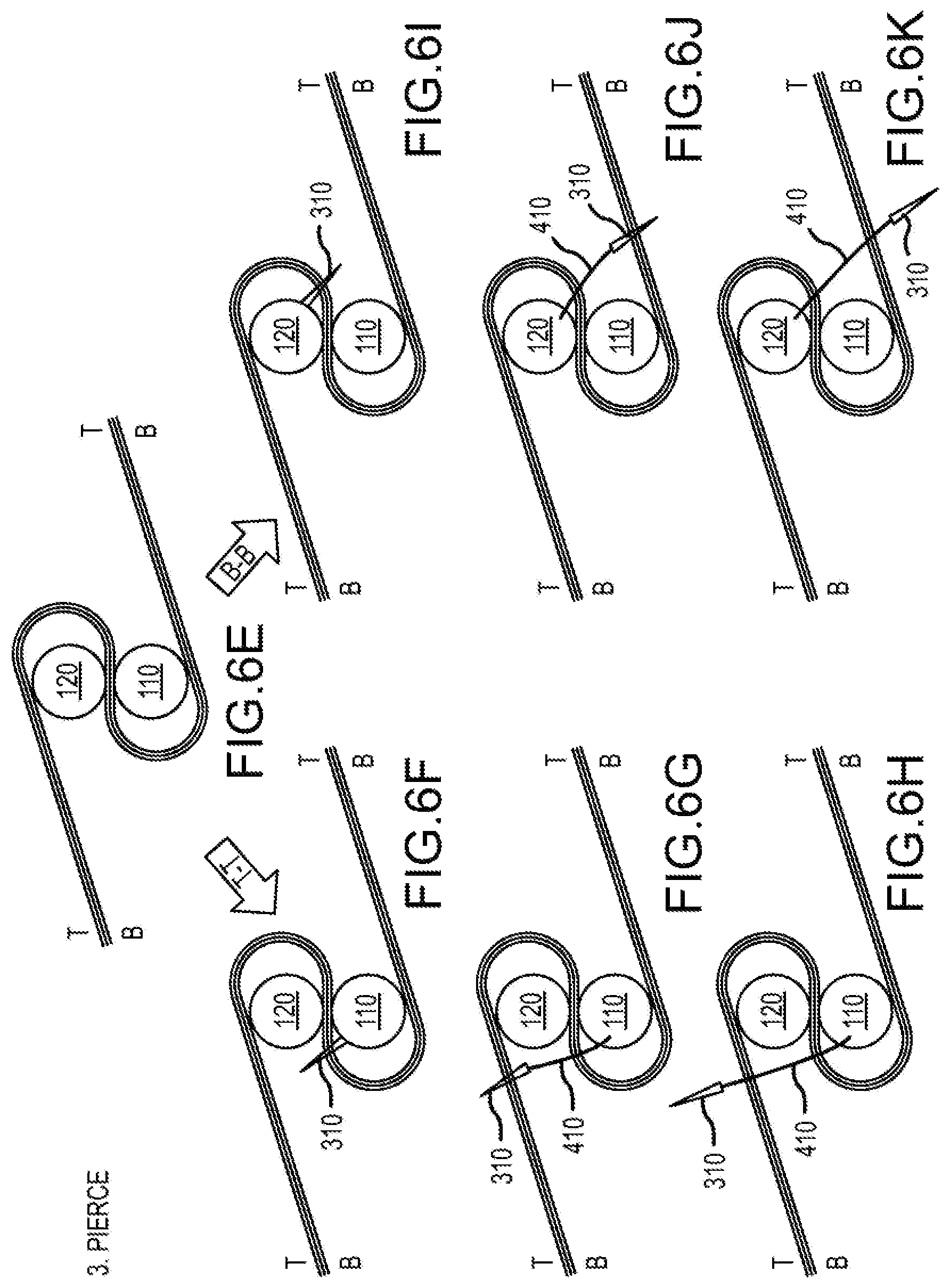 Patent US12564397 Figure 8 – Surgical device for complex suturing fibrous tissues