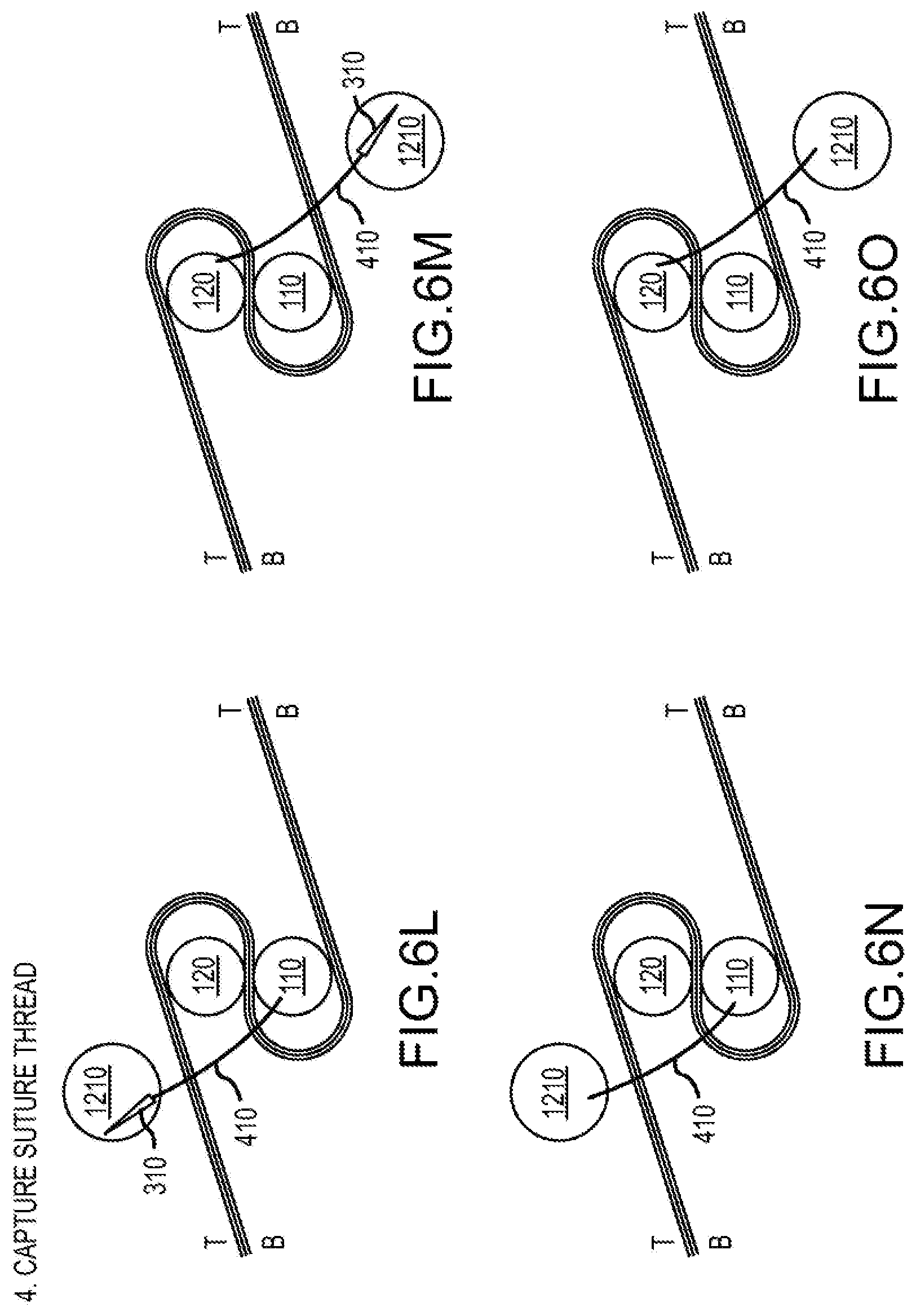 Patent US12564397 Figure 9 – Surgical device for complex suturing fibrous tissues