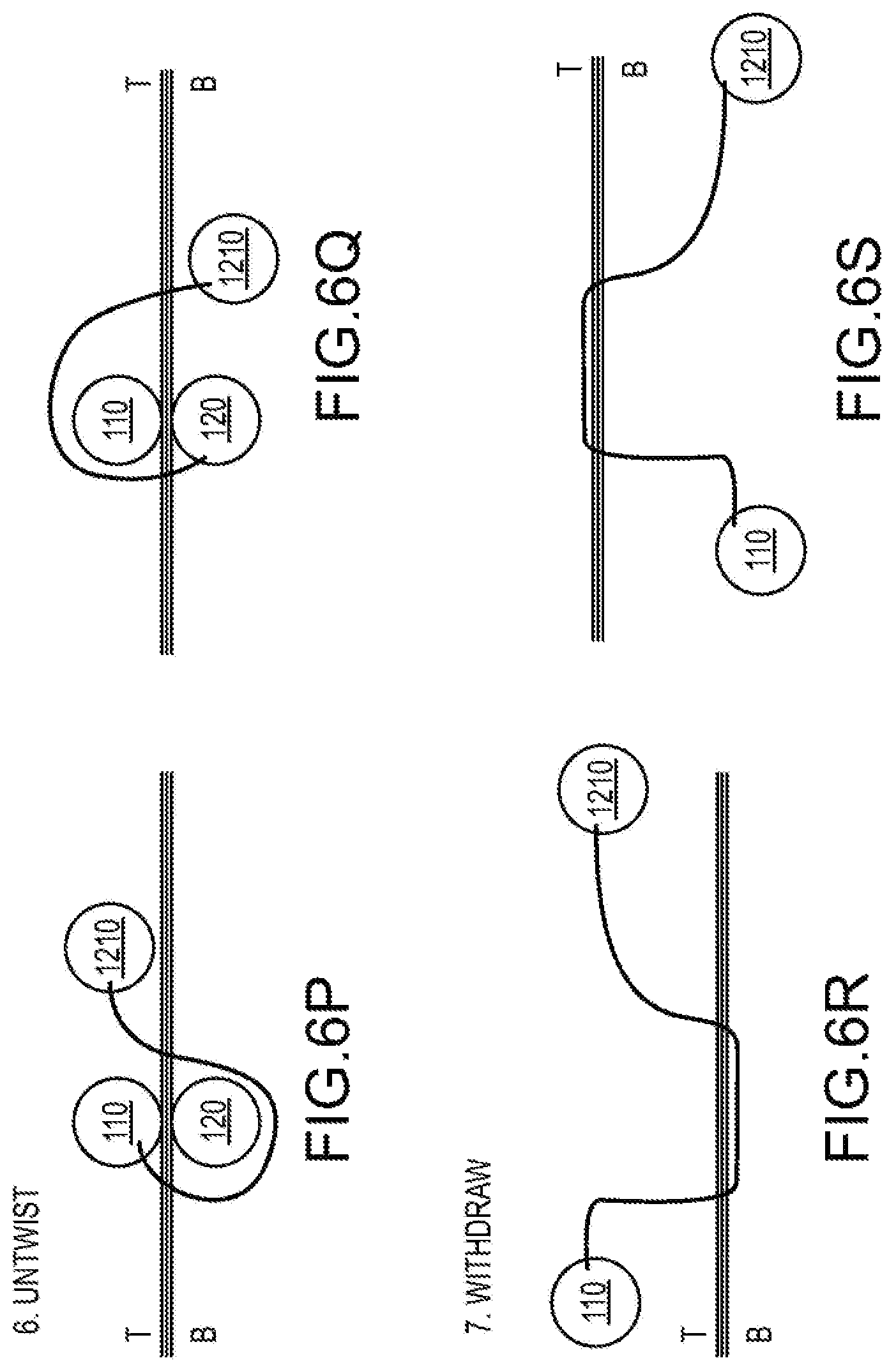 Patent US12564397 Figure 10 – Surgical device for complex suturing fibrous tissues
