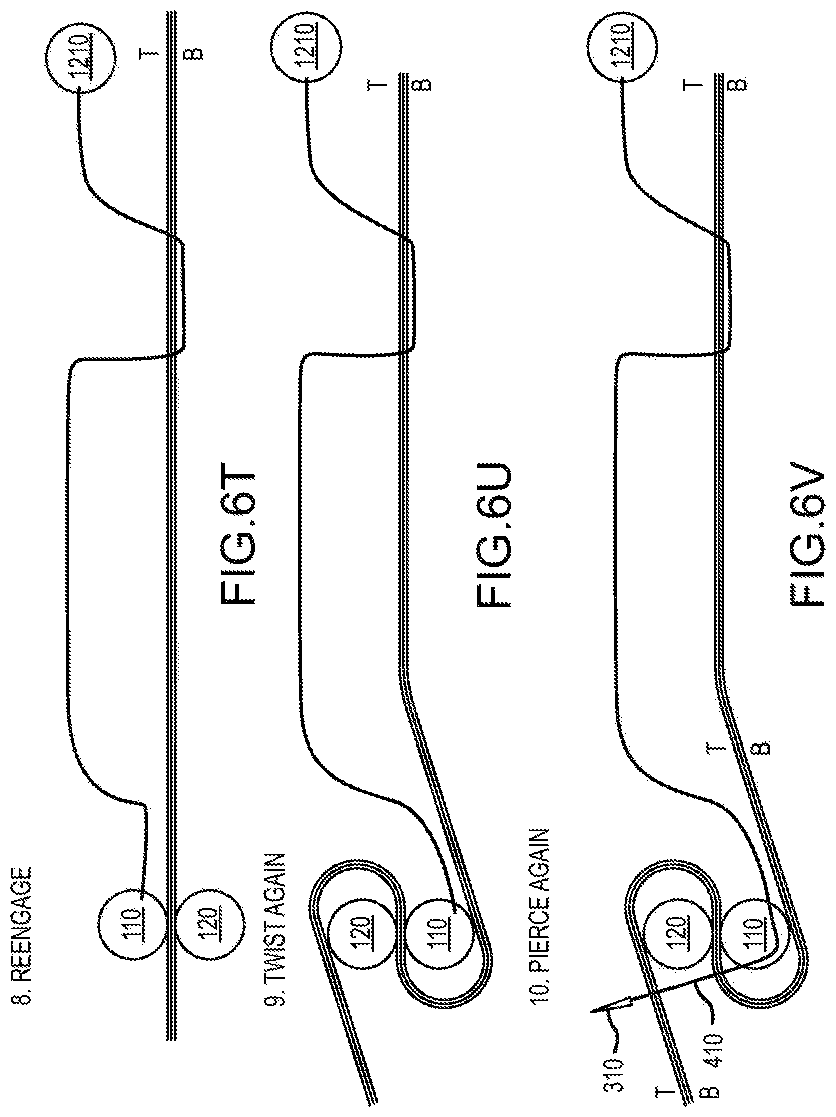 Patent US12564397 Figure 11 – Surgical device for complex suturing fibrous tissues