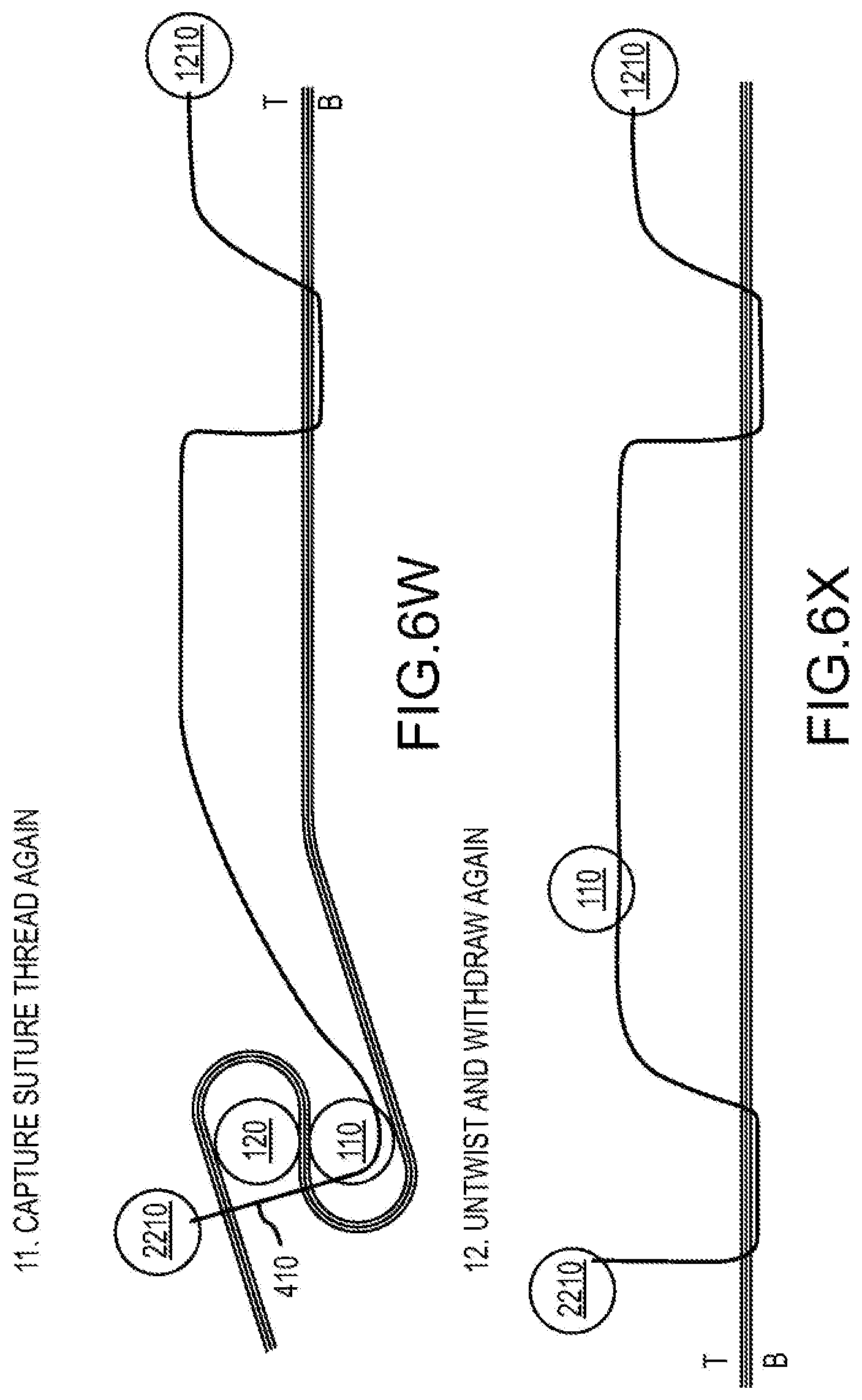 Patent US12564397 Figure 12 – Surgical device for complex suturing fibrous tissues