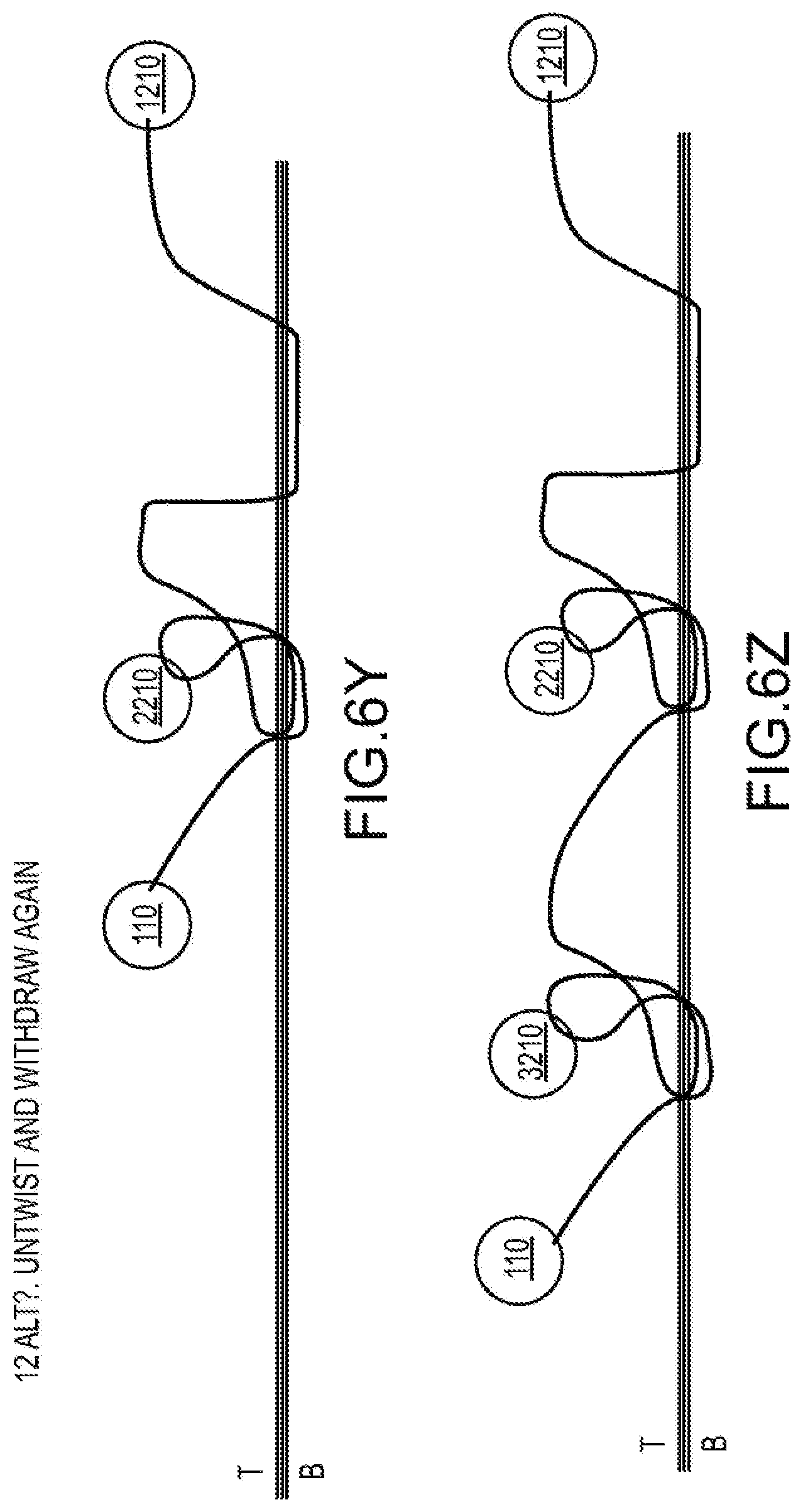 Patent US12564397 Figure 13 – Surgical device for complex suturing fibrous tissues