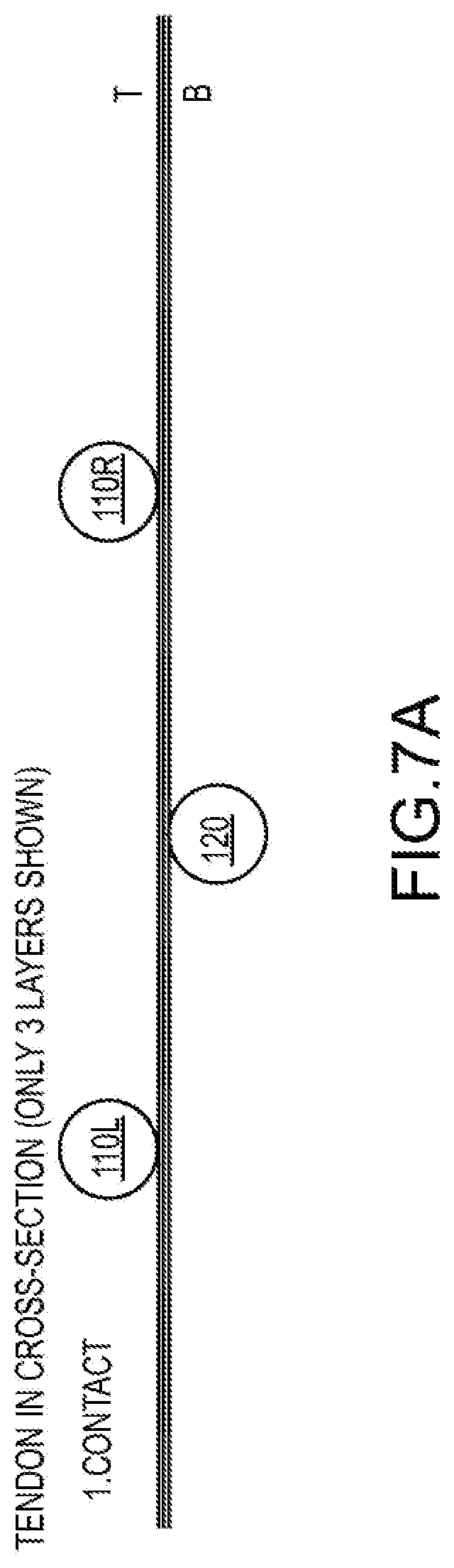 Patent US12564397 Figure 14 – Surgical device for complex suturing fibrous tissues