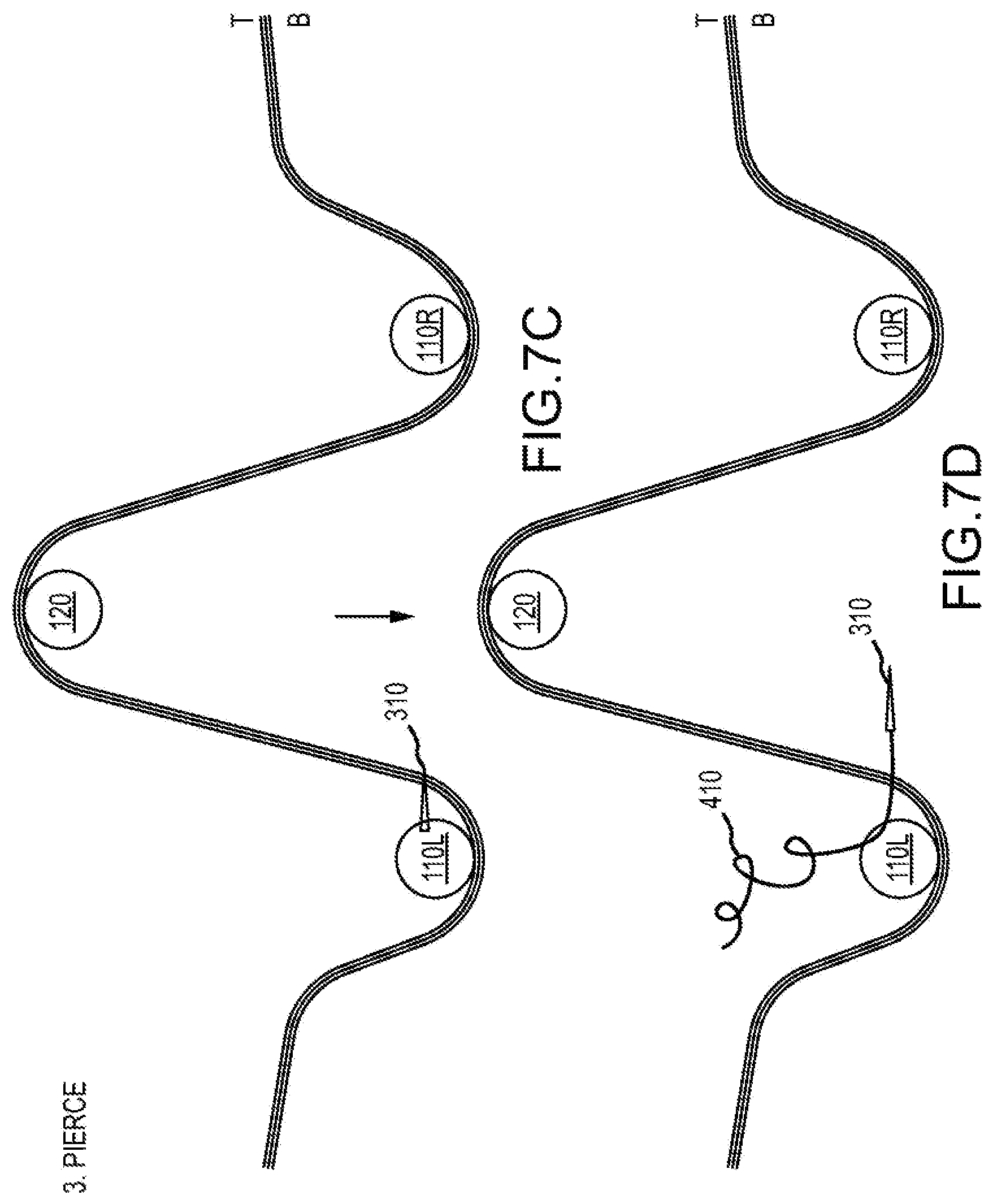 Patent US12564397 Figure 16 – Surgical device for complex suturing fibrous tissues