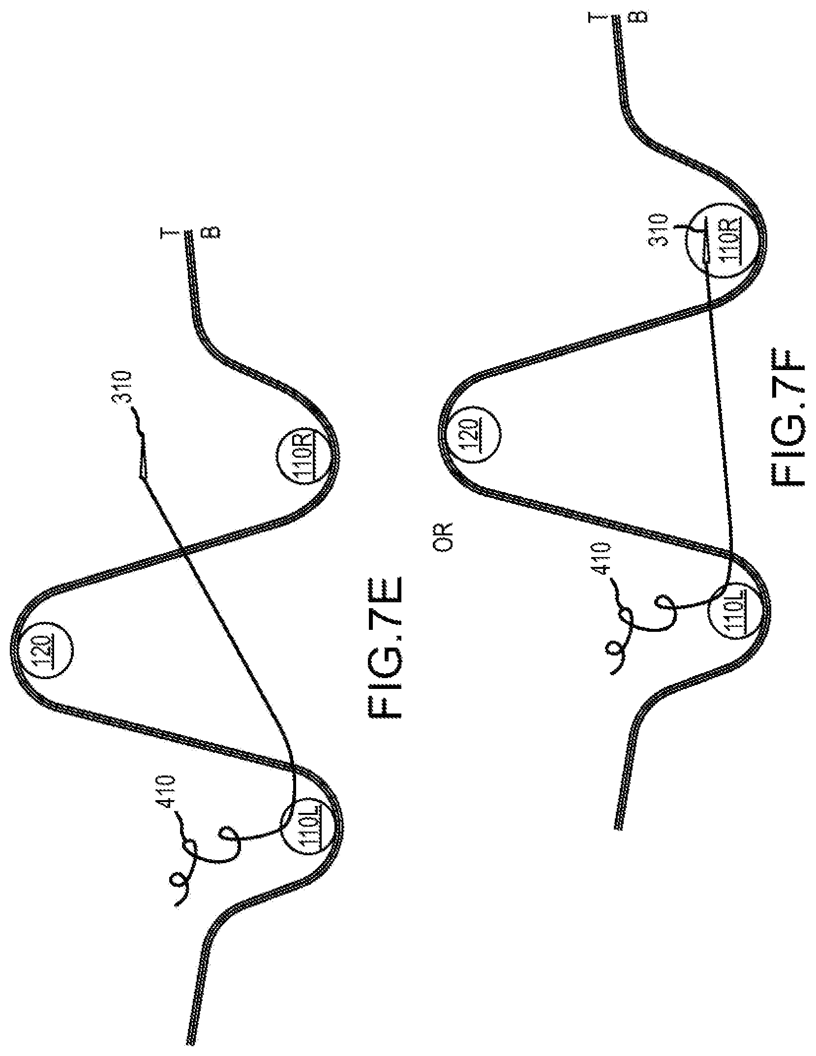 Patent US12564397 Figure 17 – Surgical device for complex suturing fibrous tissues