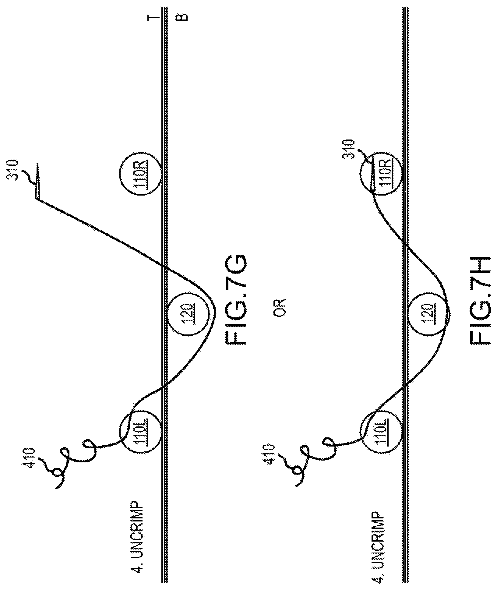 Patent US12564397 Figure 18 – Surgical device for complex suturing fibrous tissues