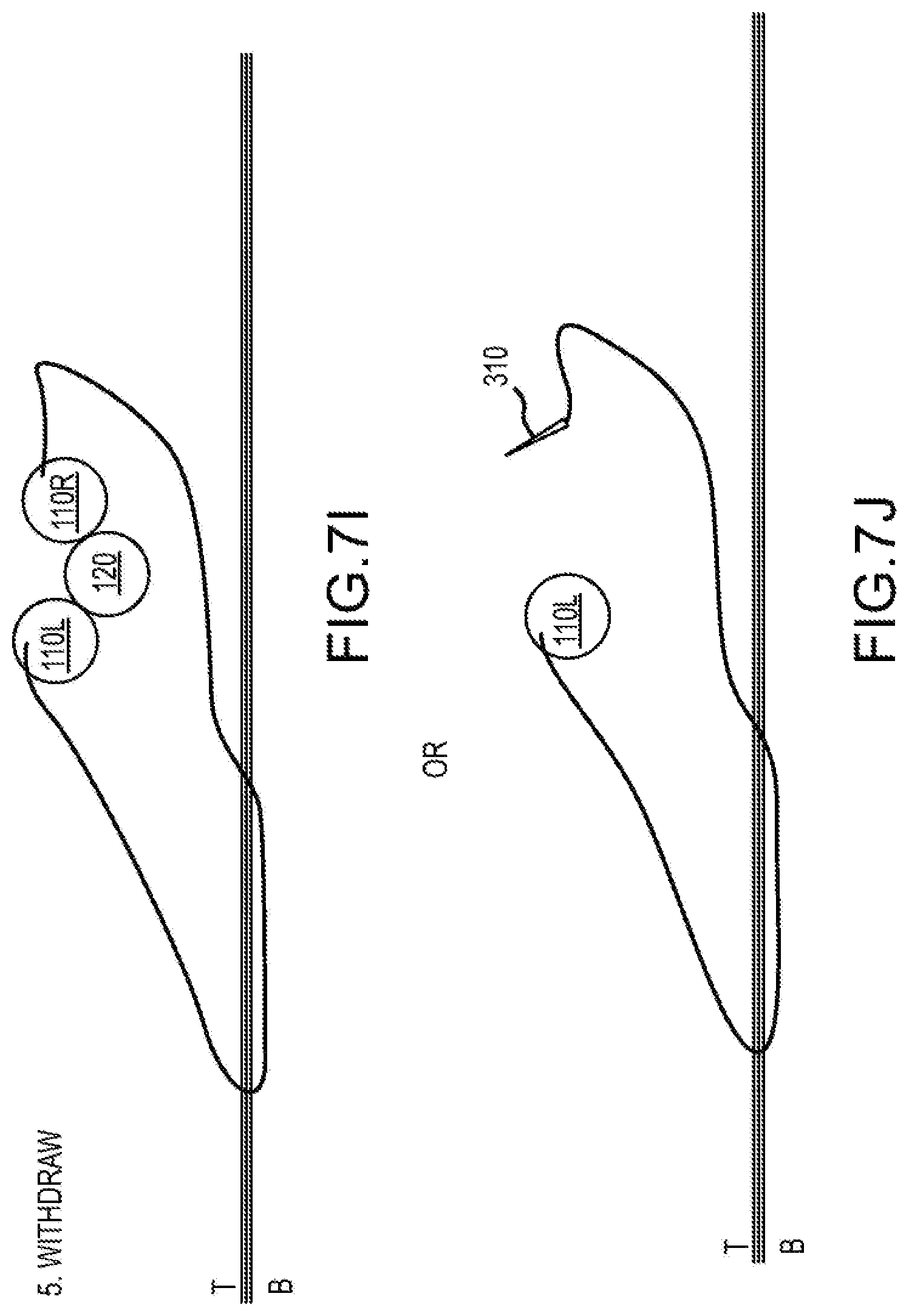 Patent US12564397 Figure 19 – Surgical device for complex suturing fibrous tissues