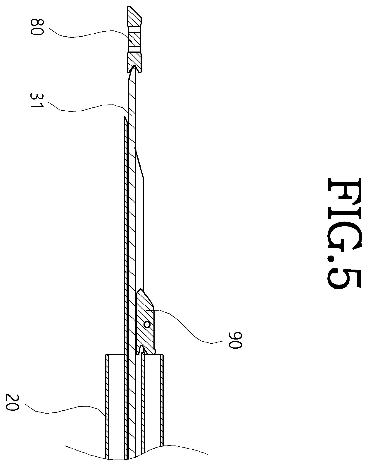 Patent US12564398 Figure 5 – Implant deployment device
