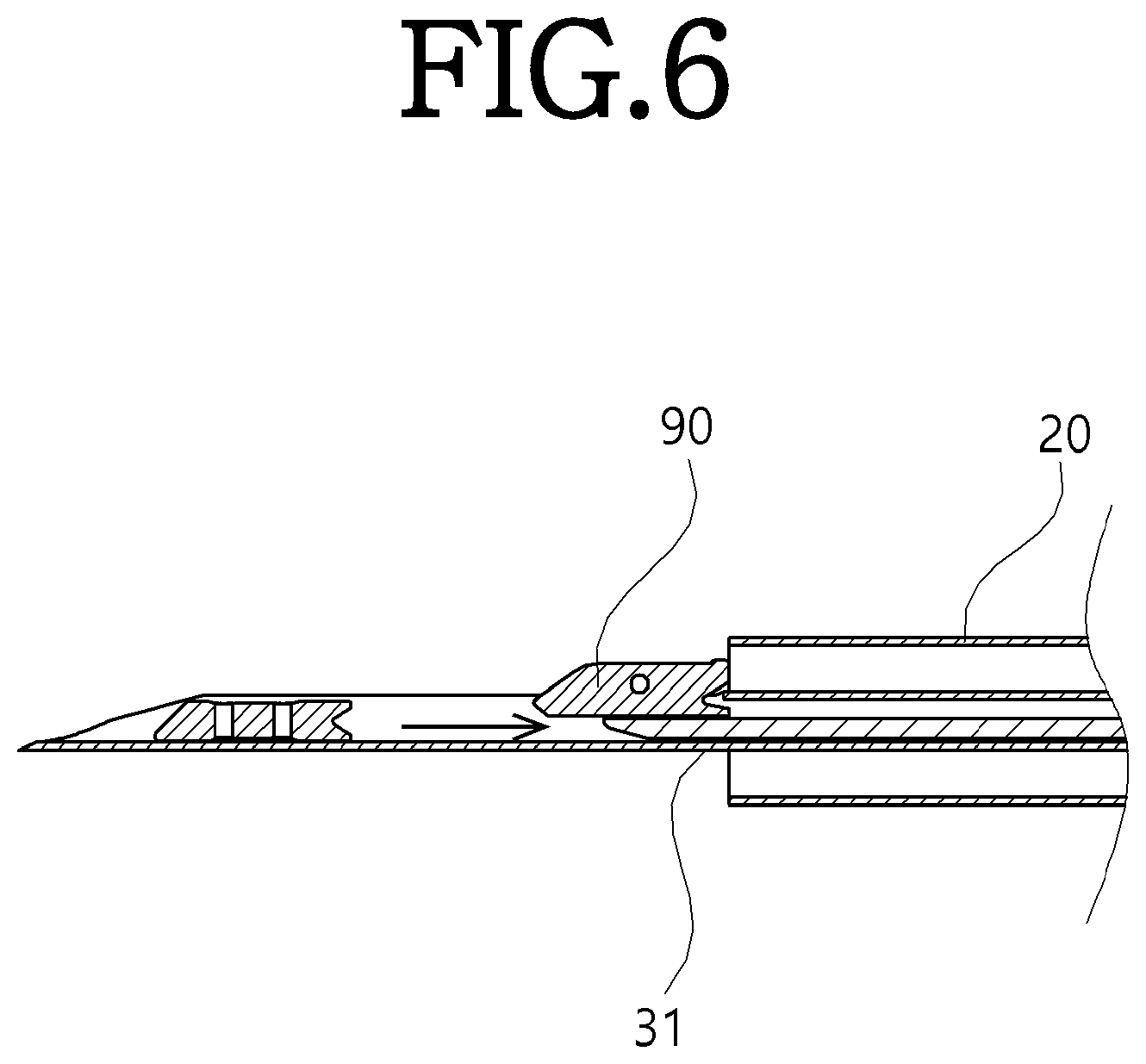 Patent US12564398 Figure 6 – Implant deployment device