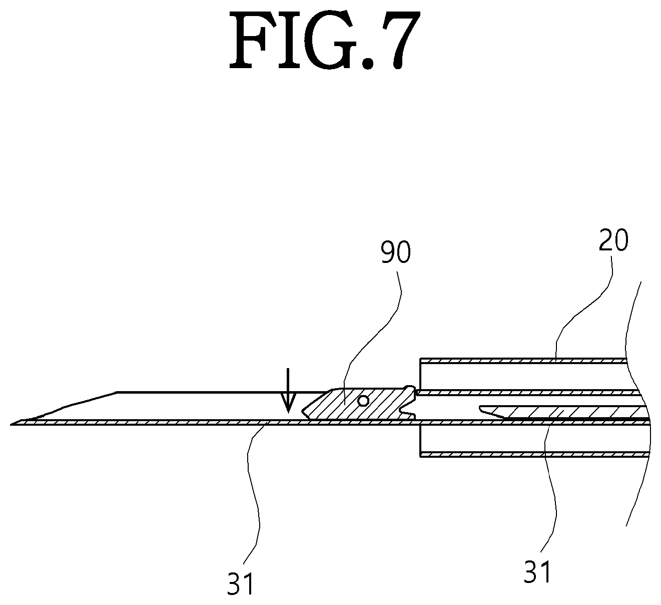 Patent US12564398 Figure 7 – Implant deployment device