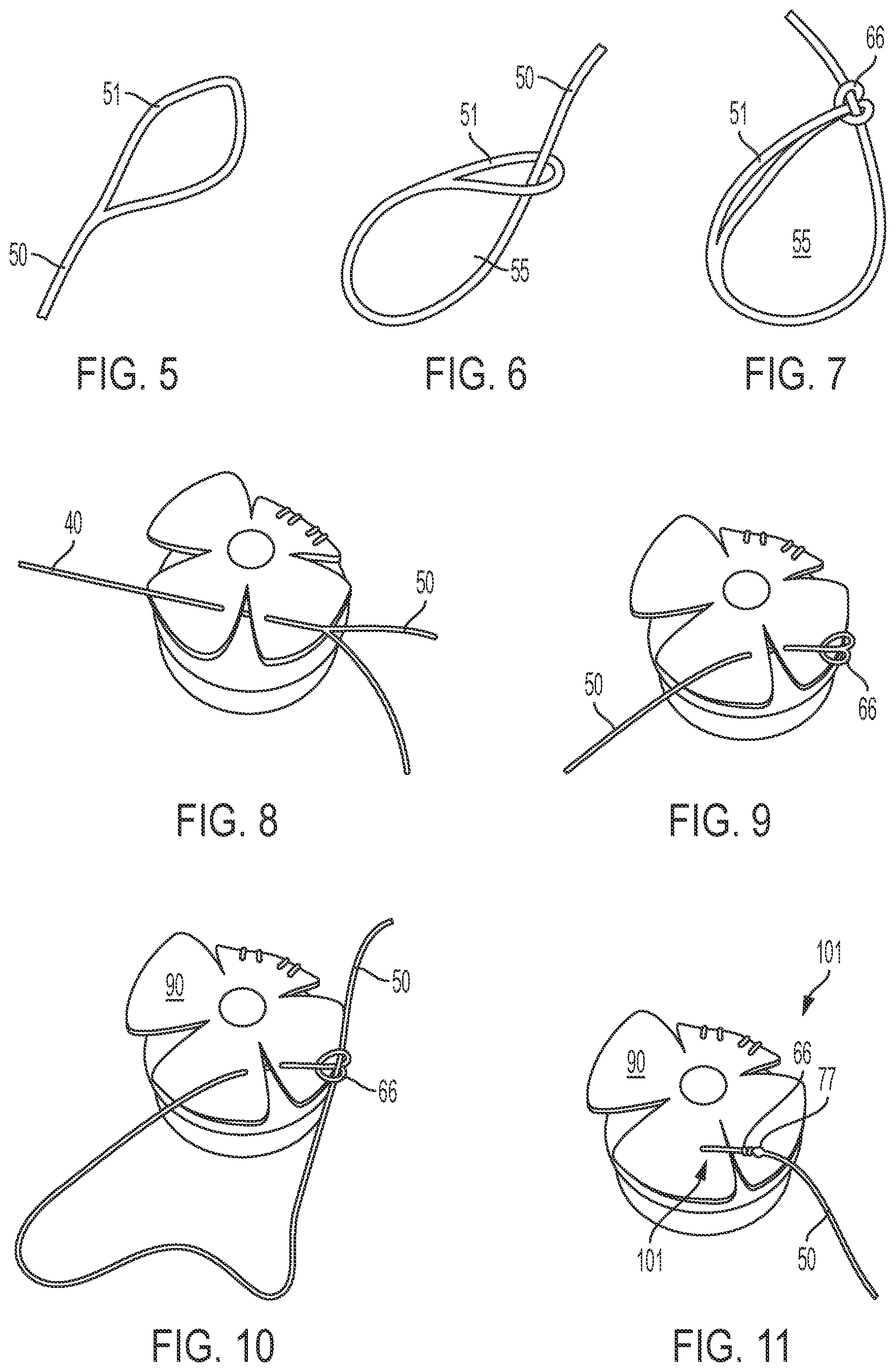 Patent US12564399 Figure 2 – Tensionable knotless surgical techniques