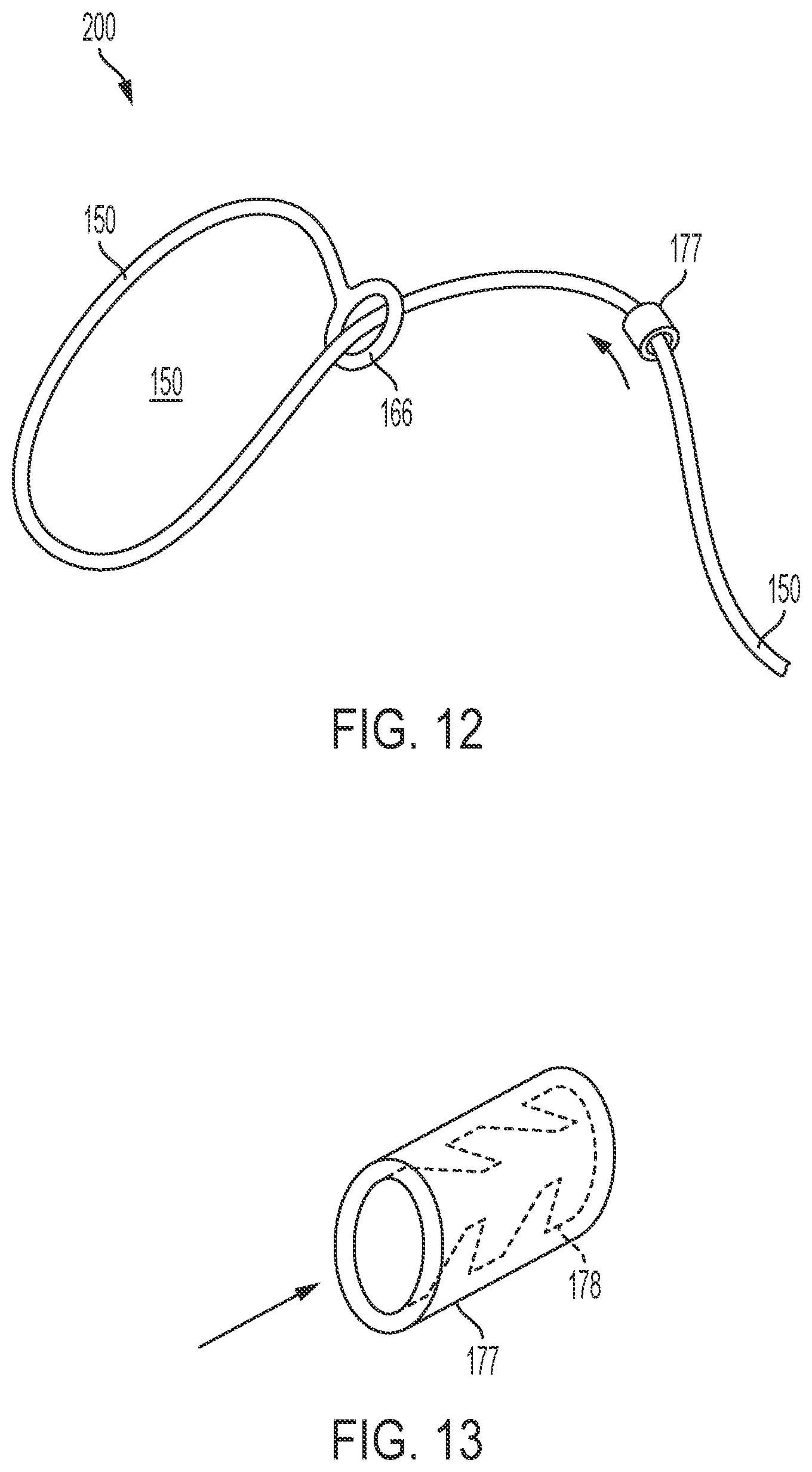 Patent US12564399 Figure 3 – Tensionable knotless surgical techniques
