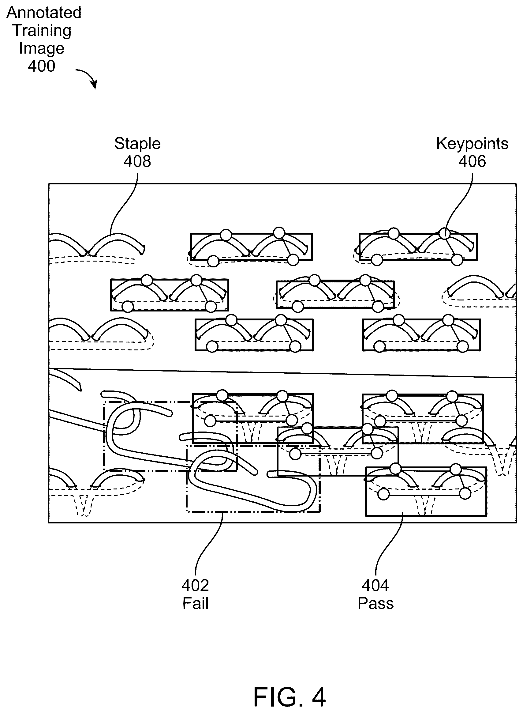 Patent US12564401 Figure 4 – Automated surgical staple inspection system
