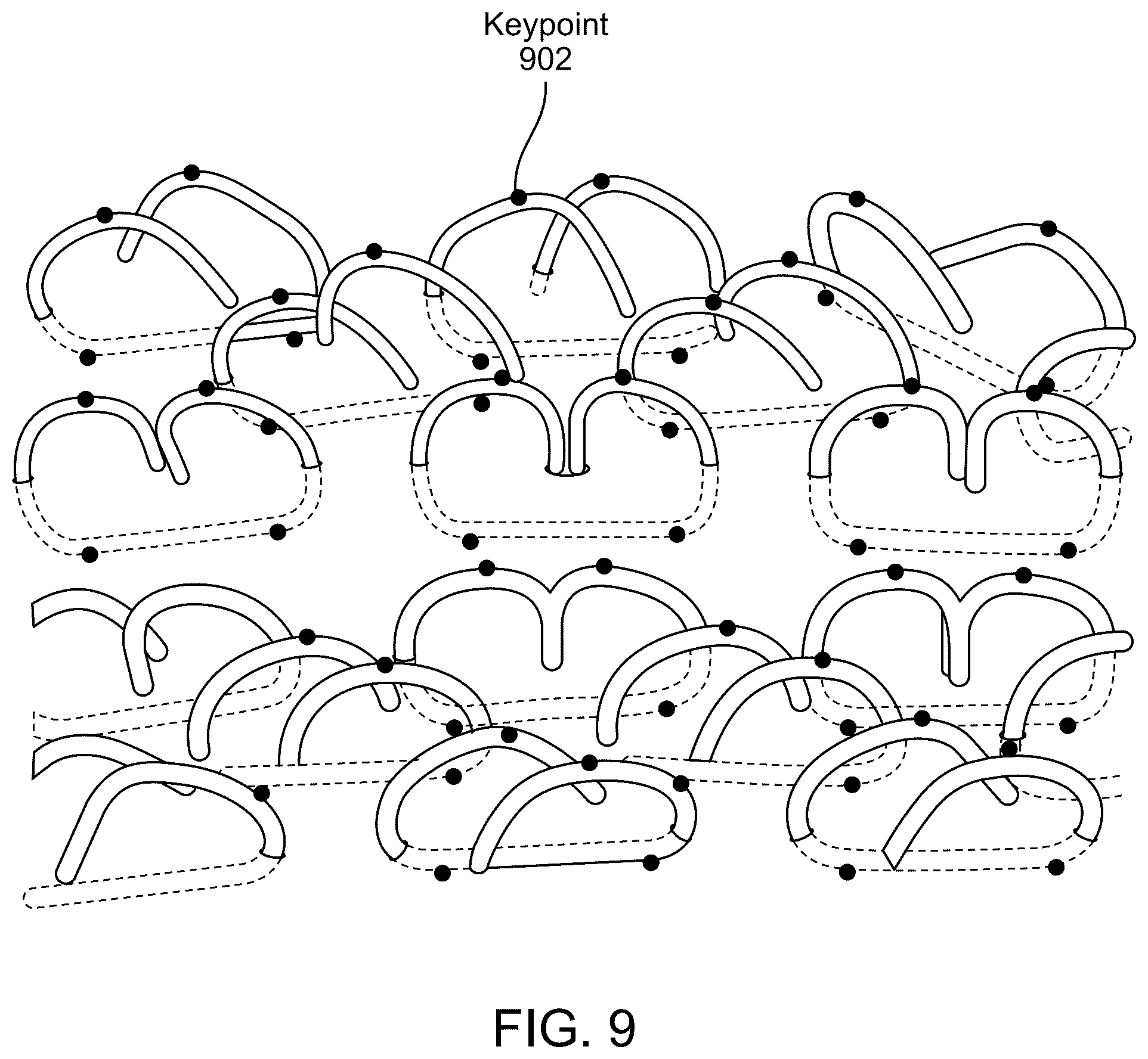 Patent US12564401 Figure 9 – Automated surgical staple inspection system