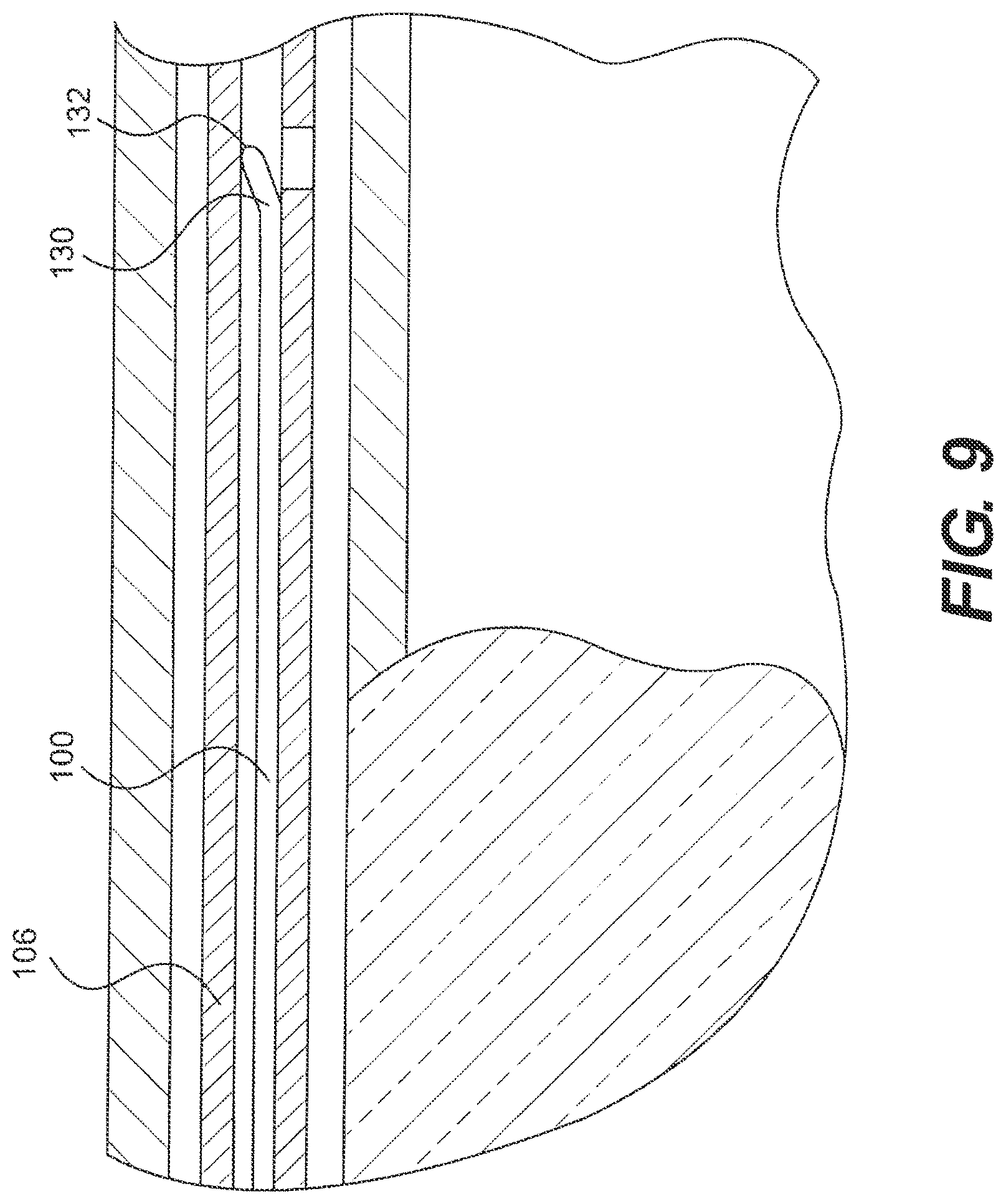 Patent US12564404 Figure 9 – Crossing occlusions in blood vessels