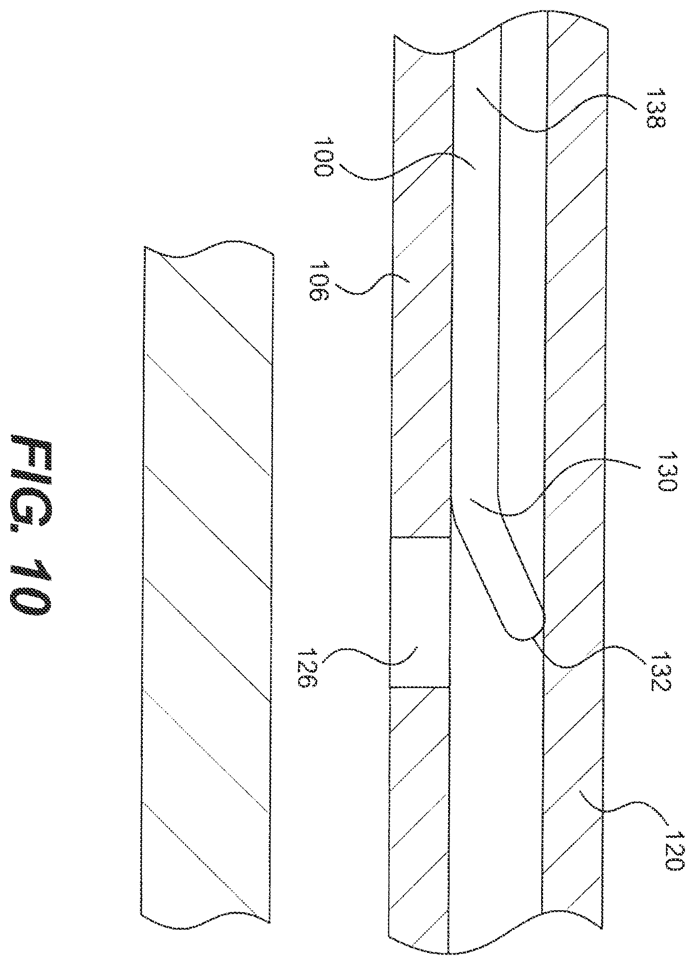 Patent US12564404 Figure 10 – Crossing occlusions in blood vessels