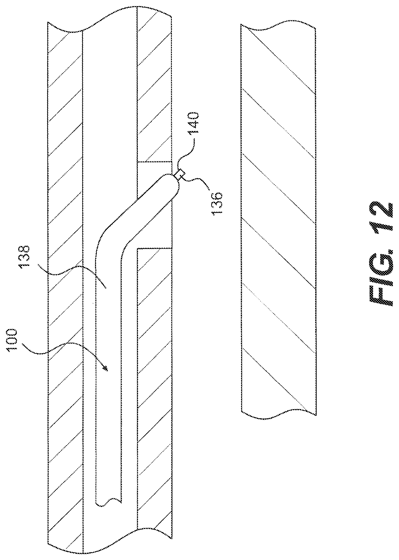 Patent US12564404 Figure 12 – Crossing occlusions in blood vessels