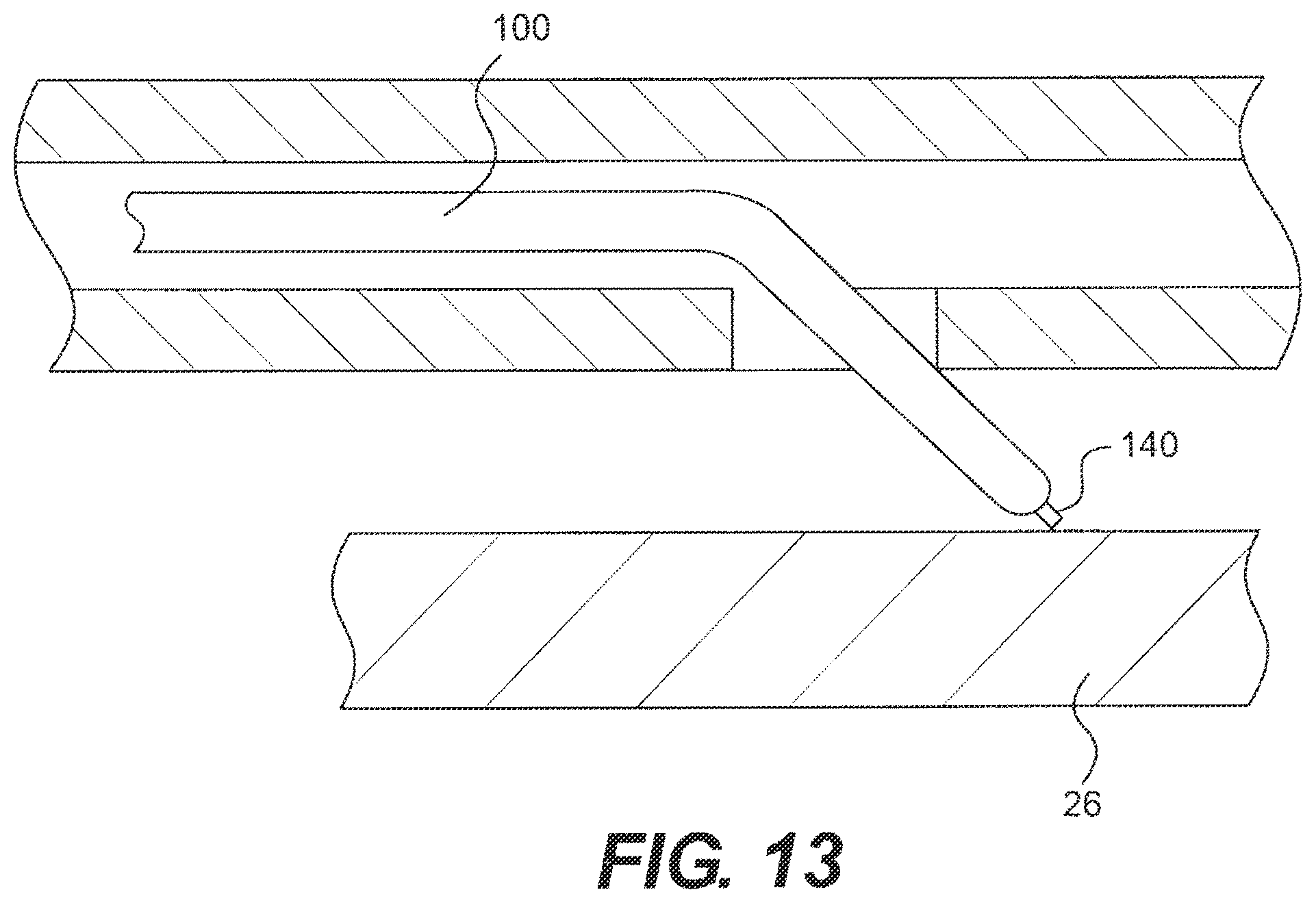Patent US12564404 Figure 13 – Crossing occlusions in blood vessels