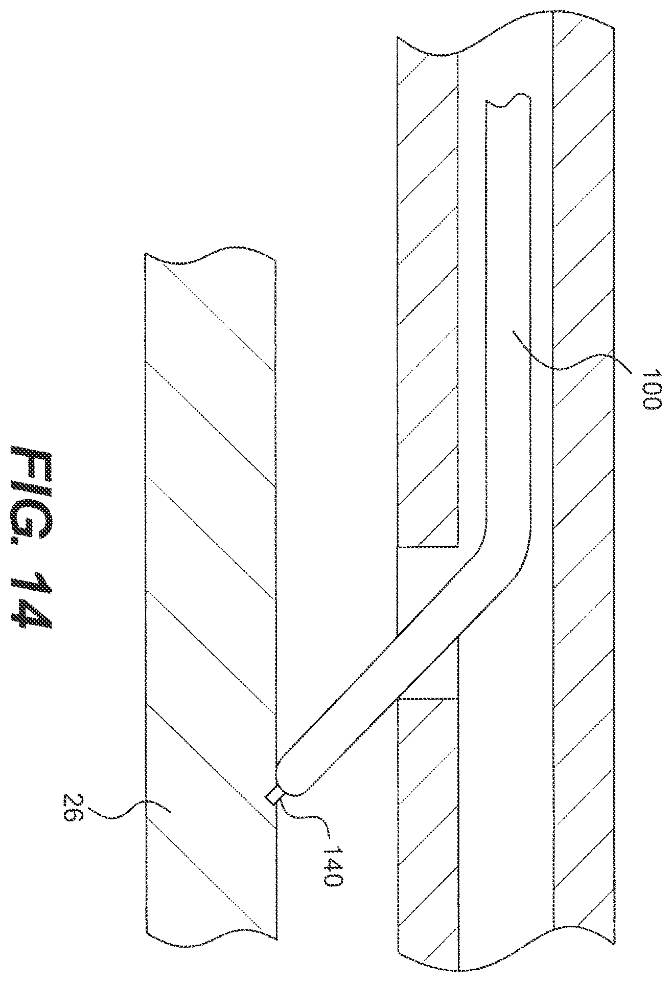 Patent US12564404 Figure 14 – Crossing occlusions in blood vessels