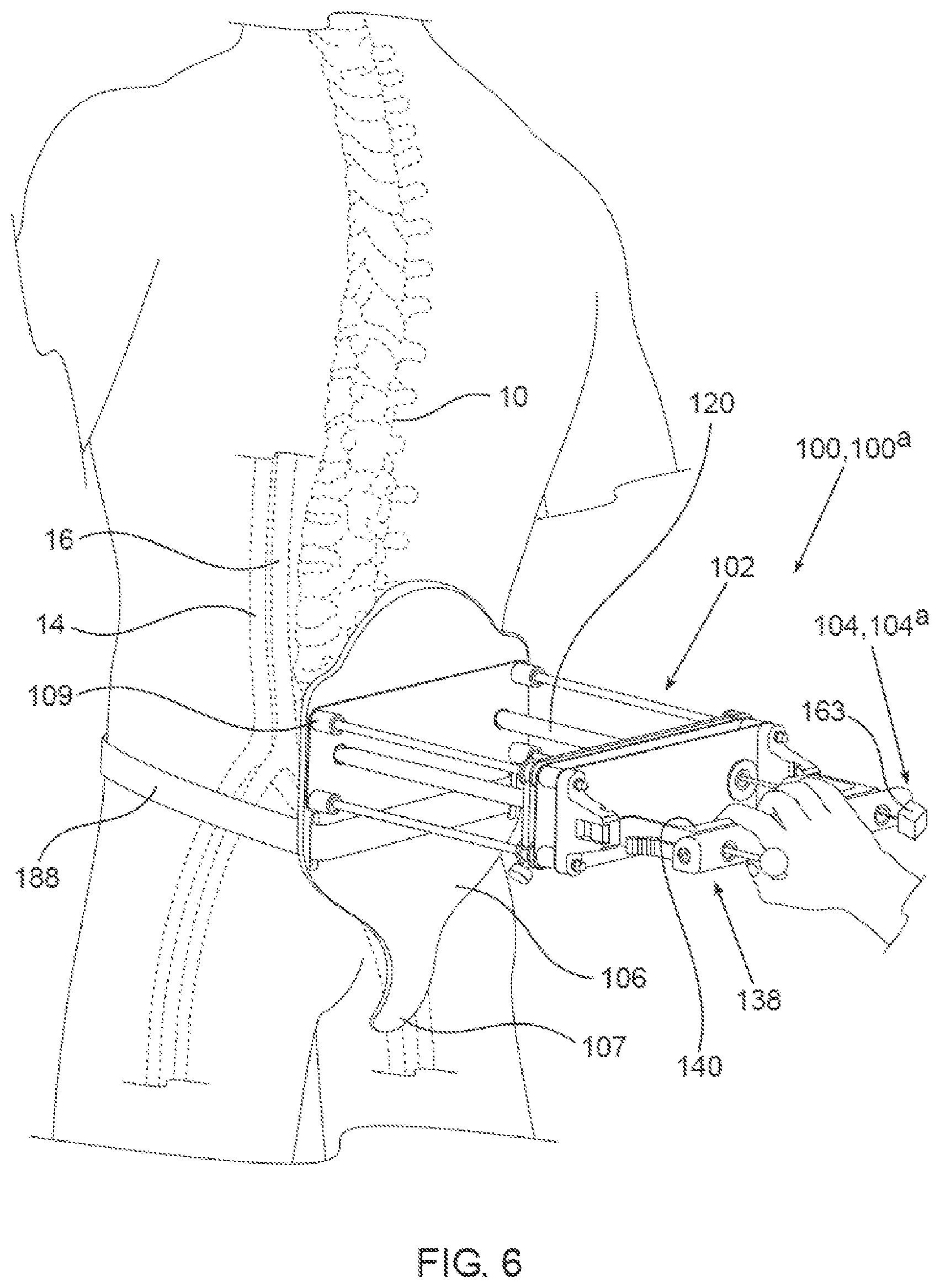 Patent US12564405 Figure 6 – Blood vessel compression systems