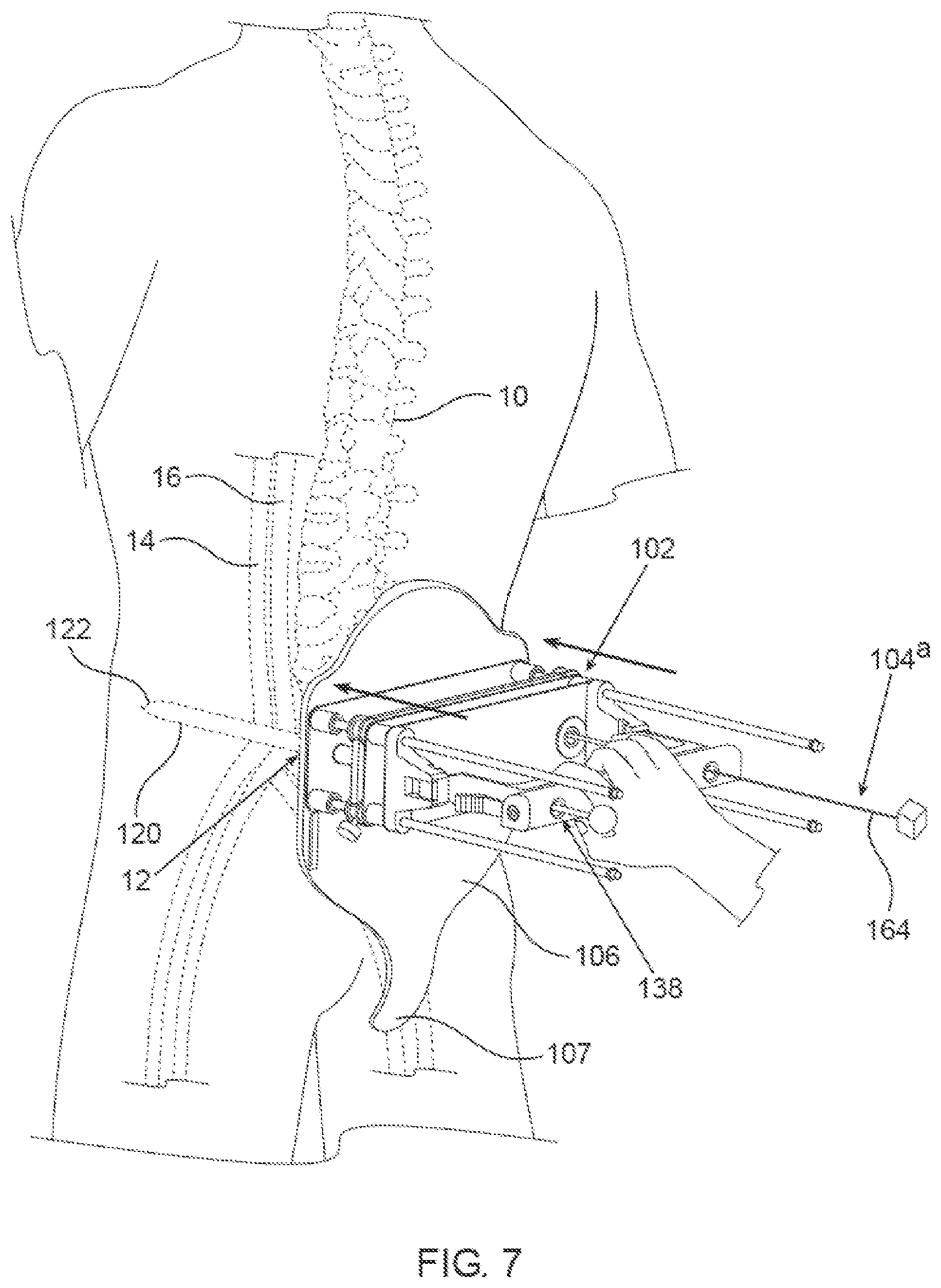 Patent US12564405 Figure 7 – Blood vessel compression systems