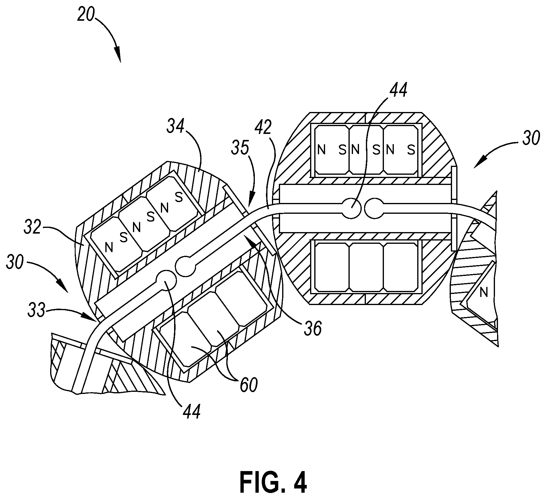 Patent US12564406 Figure 4 – Implantable sphincter assistance device with bimodal circumferential restriction force threshold