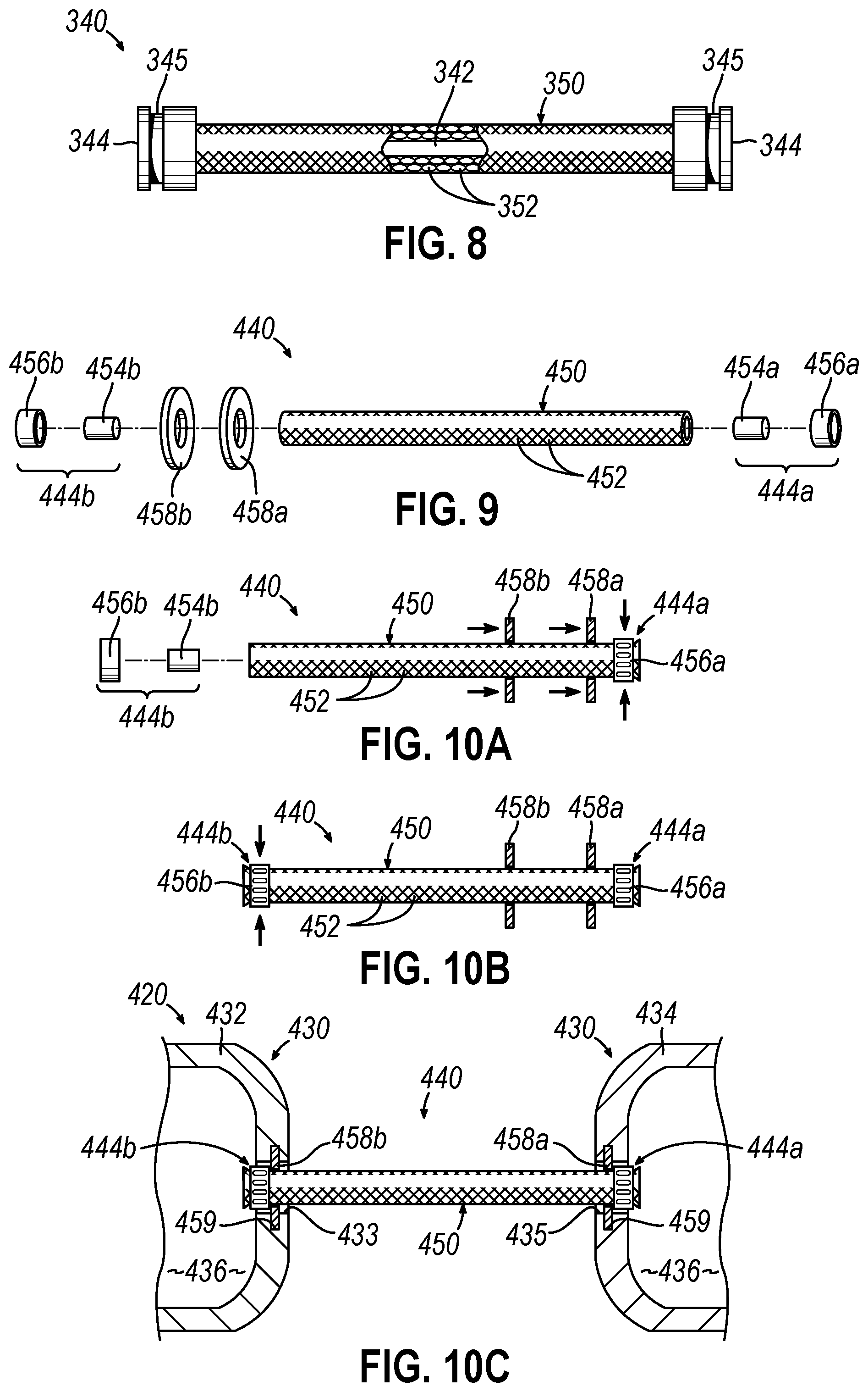 Patent US12564406 Figure 8 – Implantable sphincter assistance device with bimodal circumferential restriction force threshold