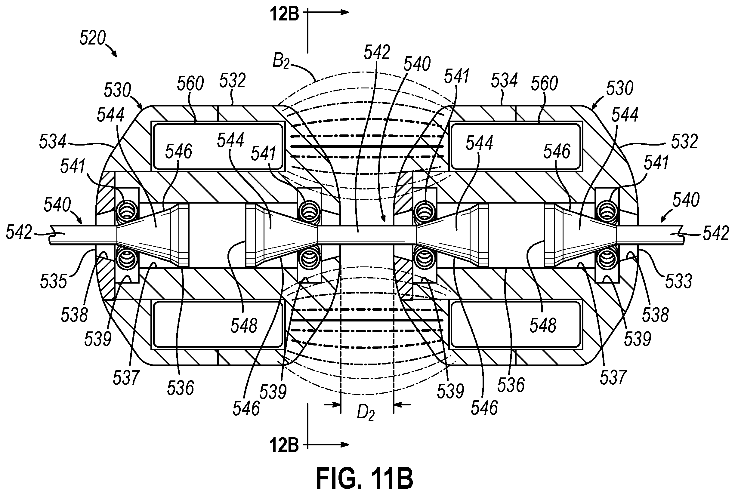 Patent US12564406 Figure 10 – Implantable sphincter assistance device with bimodal circumferential restriction force threshold