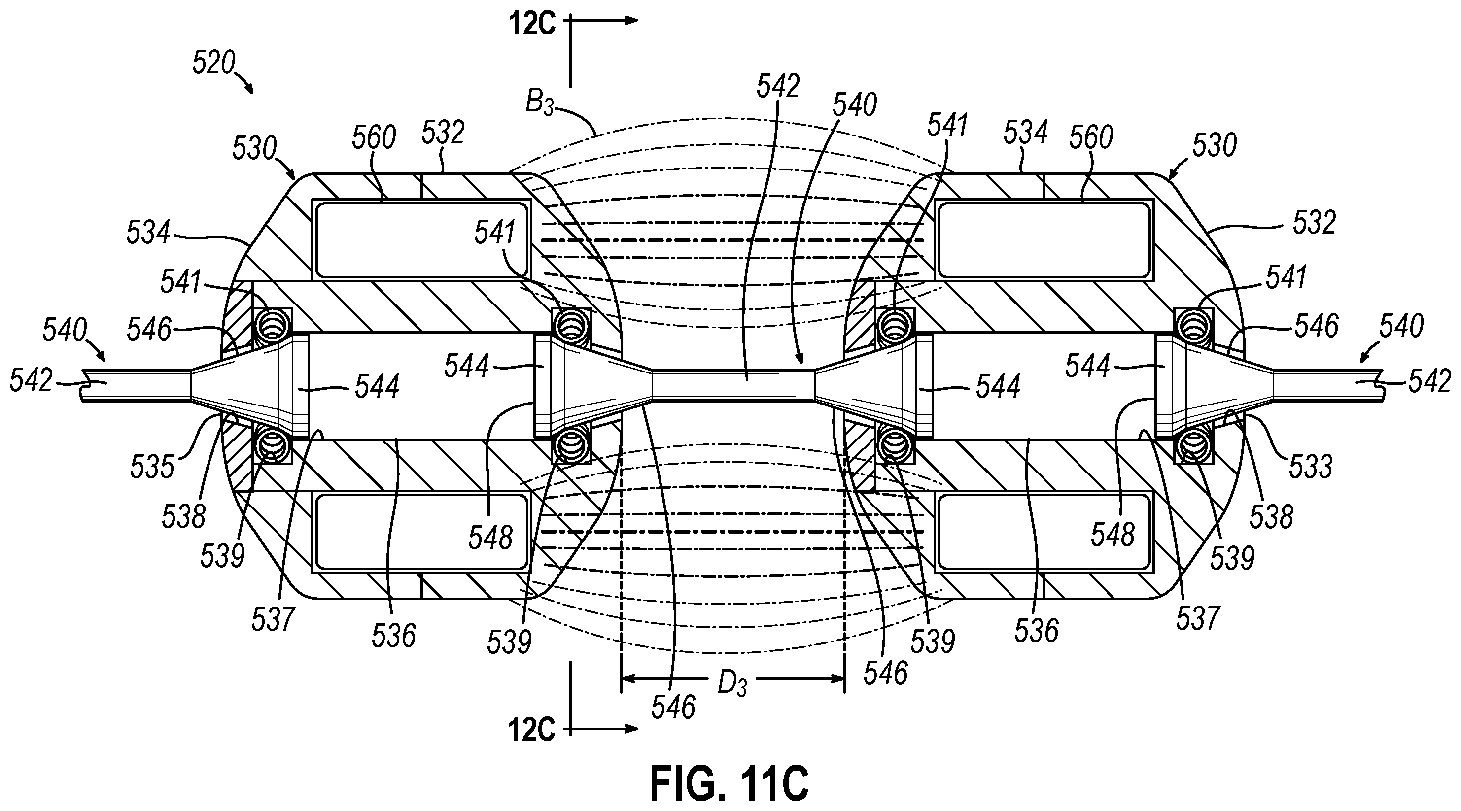 Patent US12564406 Figure 11 – Implantable sphincter assistance device with bimodal circumferential restriction force threshold